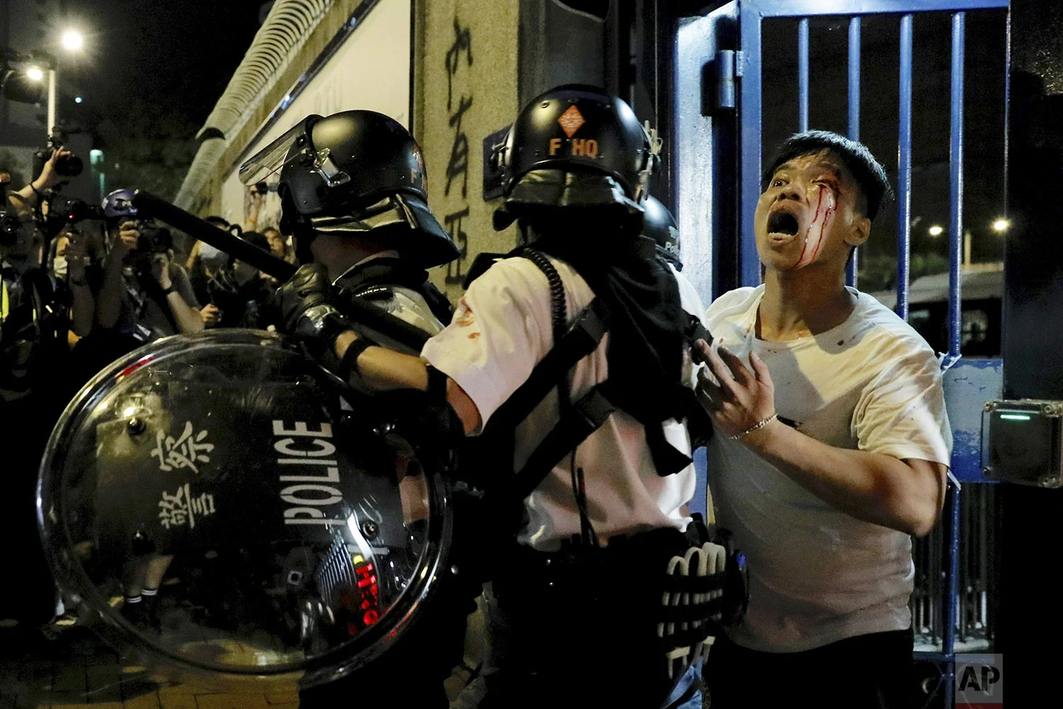 A bleeding man is taken away by policemen after attacked by protesters outside Kwai Chung police station in Hong Kong, Wednesday, July 31, 2019. (AP Photo/Vincent Yu)