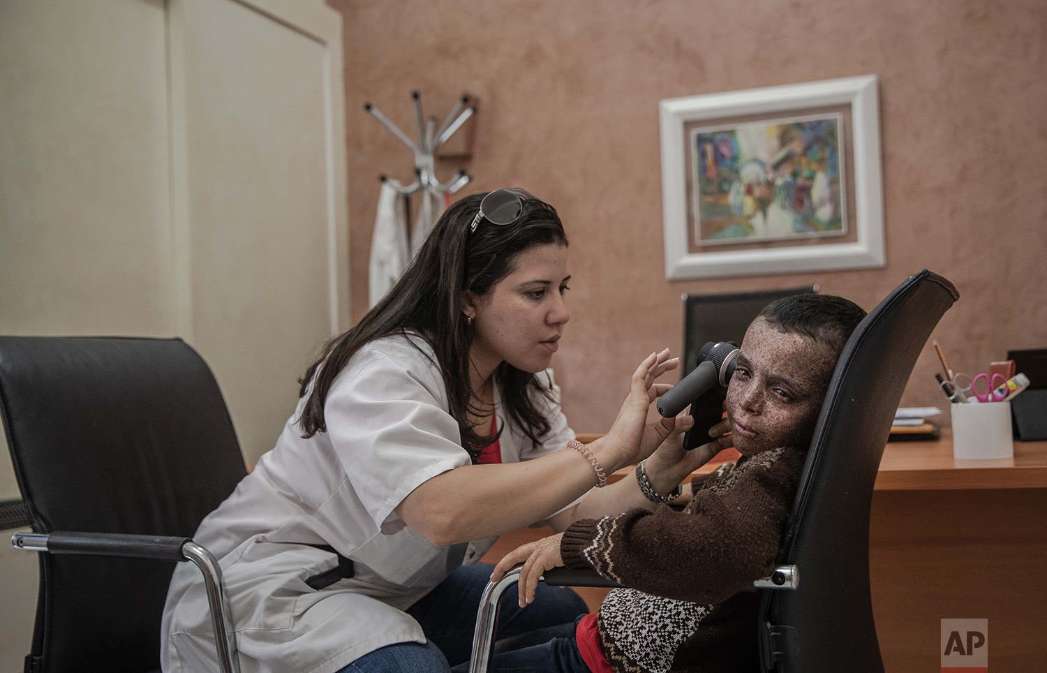 A nurse performs skin checkups for 8-year-old Mustapha, who is affected by a rare disorder called xeroderma pigmentosum, or XP, inside a hospital in Casablanca, Morocco, July 24, 2019. (AP Photo/Mosa'ab Elshamy)