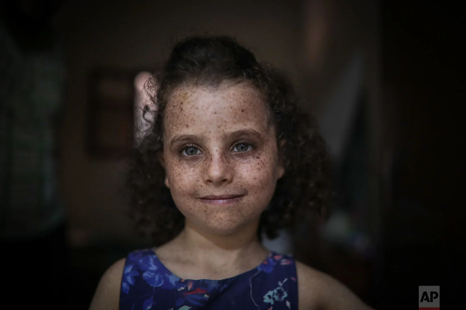 Romaisae, 6, who is affected by a rare disorder called xeroderma pigmentosum, or XP, poses for a portrait in her home in the town of Sale, near Rabat, Morocco, July 23, 2019. (AP Photo/Mosa'ab Elshamy)