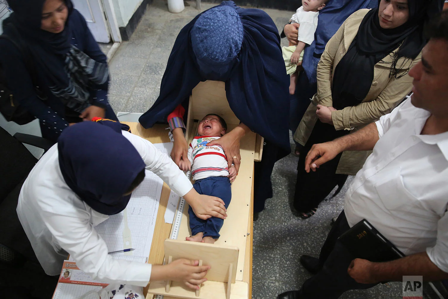 A doctor measures the height of a malnourished boy at a hospital in Charikar, north of Kabul, Afghanistan, Aug. 26, 2019. (AP Photo/Rafiq Maqbool)