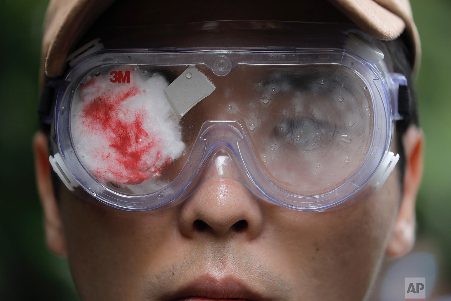  A pro-democracy protester with his eye covered in red-eyepatch, symbolizing a women reported to have had an eye ruptured by a beanbag round fired by police during clashes, participates in a march organized by teachers in Hong Kong Saturday, Aug. 17,
