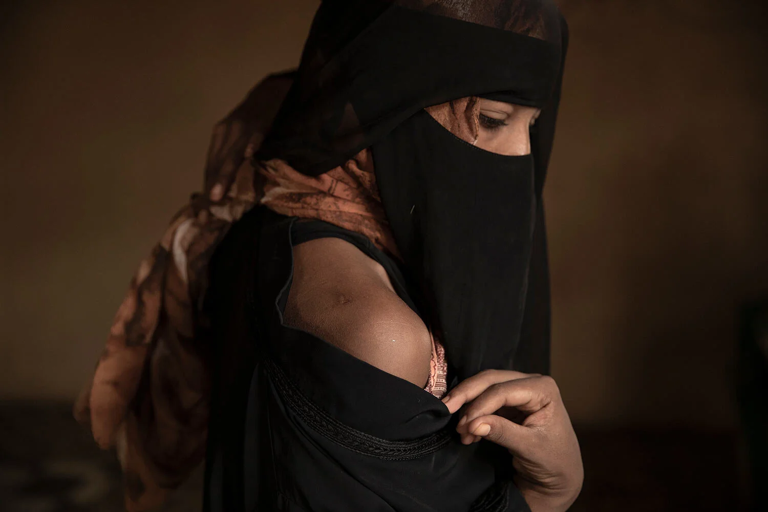 Ethiopian migrant Eman Idrees shows her shoulder with a wound from torture after being held and abused for eight months in a desert compound known in Arabic as a "hosh," run by an Ethiopian smuggler in Ras al-Ara, Lahj, Yemen. (AP Photo/Nariman El-Mofty)