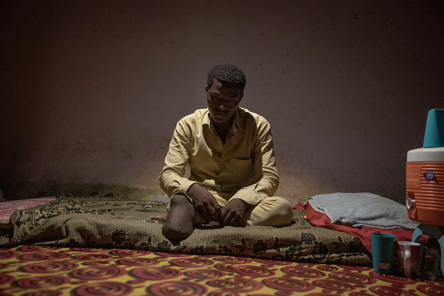 17-year-old Ethiopian migrant Abdul-Rahman Taha, shows his amputated leg, at his home, in Basateen, a district of Aden, Yemen. (AP Photo/Nariman El-Mofty)