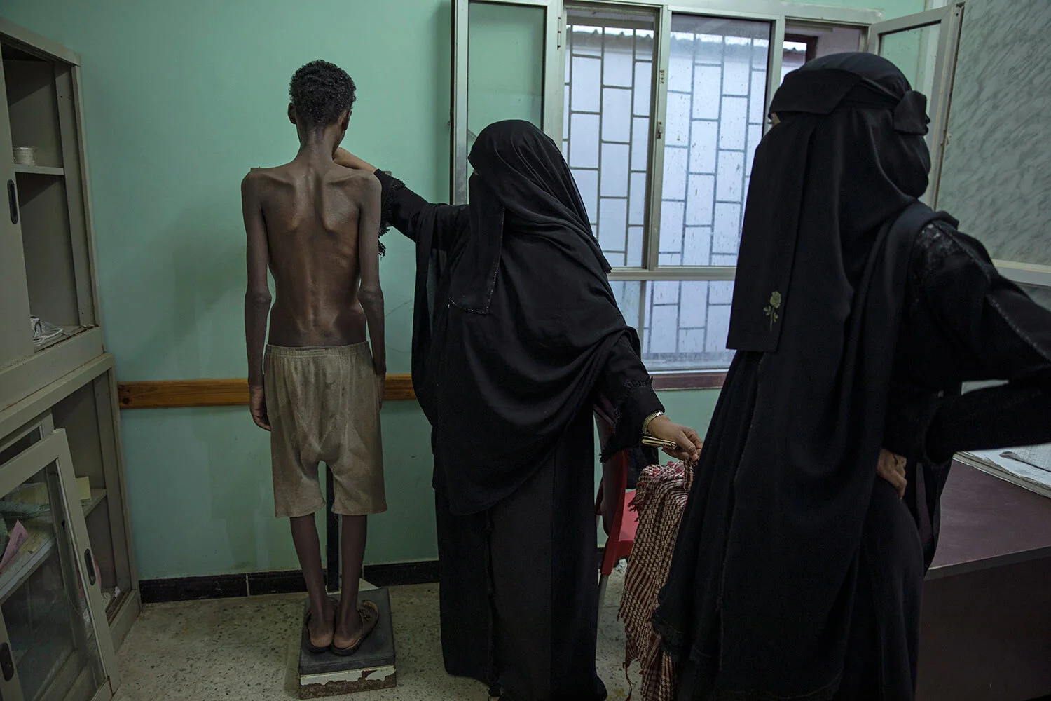 19-year-old Ethiopian migrant Mohammed Hussein, who is severely malnourished from imprisonment by smugglers, stands on a scale at the Ras al-Ara Hospital in Lahj, Yemen. He weighs 31 kilograms (68 pounds). (AP Photo/Nariman El-Mofty)
