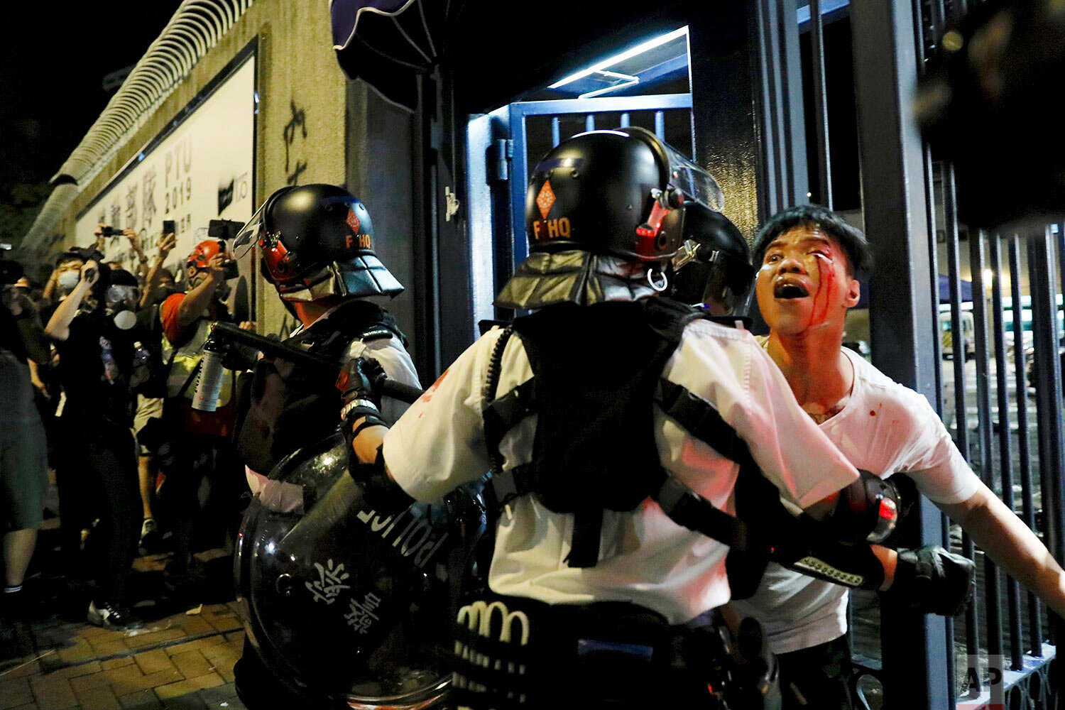  A bleeding man is taken away by policemen after he was attacked by protesters outside Kwai Chung police station in Hong Kong on July 31, 2019. (AP Photo/Vincent Yu) 