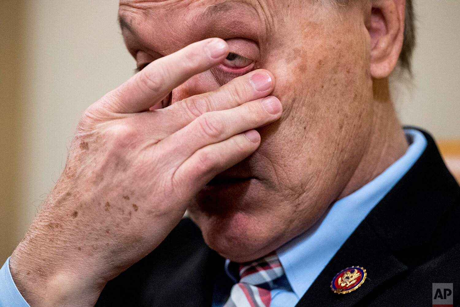  Rep. Andy Biggs, R-Ariz., rubs his eyes during a House Judiciary Committee markup of the articles of impeachment against President Donald Trump, Thursday, Dec. 12, 2019, on Capitol Hill in Washington. (AP Photo/Andrew Harnik) 
