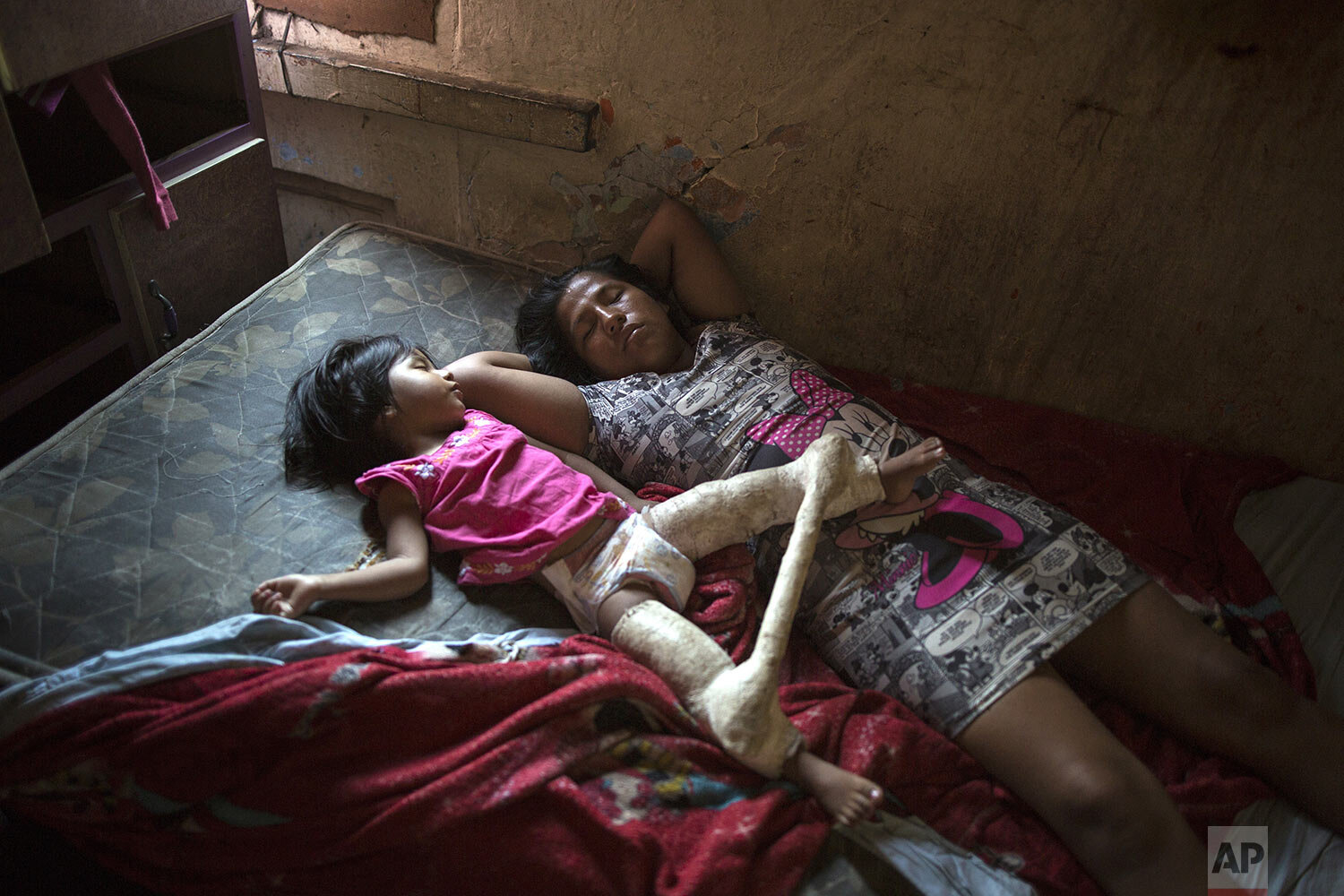  In this March 19, 2020 photo, Nilu Asca and her 2-year-old daughter Darleth, who wears a spica cast to treat hip dysplasia, sleep inside their small room inside a building nicknamed “Luriganchito,” after the country’s most populous prison, in Lima, 