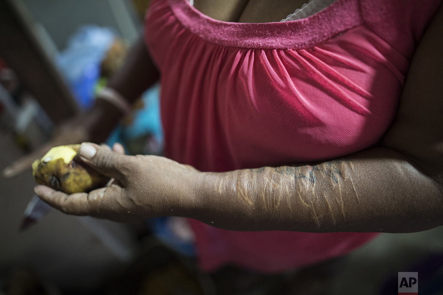  In this April 5, 2020 photo, Carmen Rosa de la Cruz, whose arm is scarred from self-harm, peels potatoes as she prepares a soup inside the deteriorating building nicknamed “Luriganchito,” after the country’s most populous prison, in Lima, Peru. (AP 