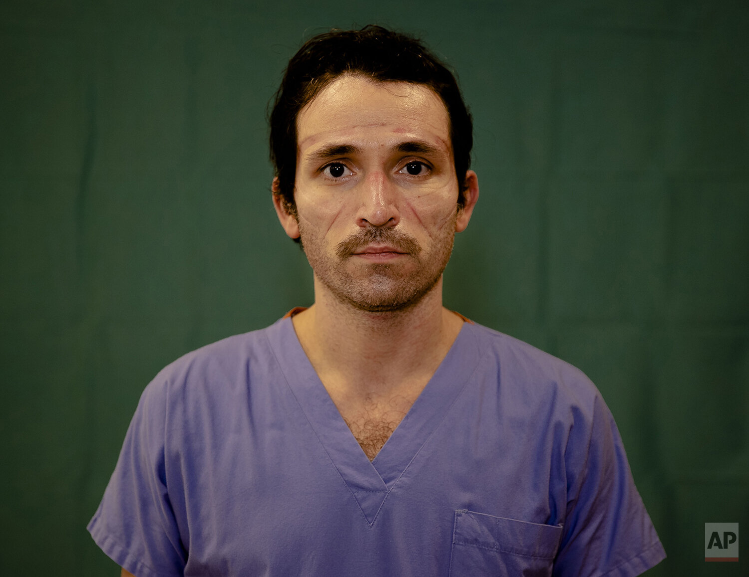  Doctor Luca Tarantino, 37, an electrophysiologist at the Humanitas Gavazzeni Hospital in Bergamo, Italy poses for a portrait at the end of his shift Friday, March 27, 2020. The intensive care doctors and nurses on the front lines of the coronavirus 