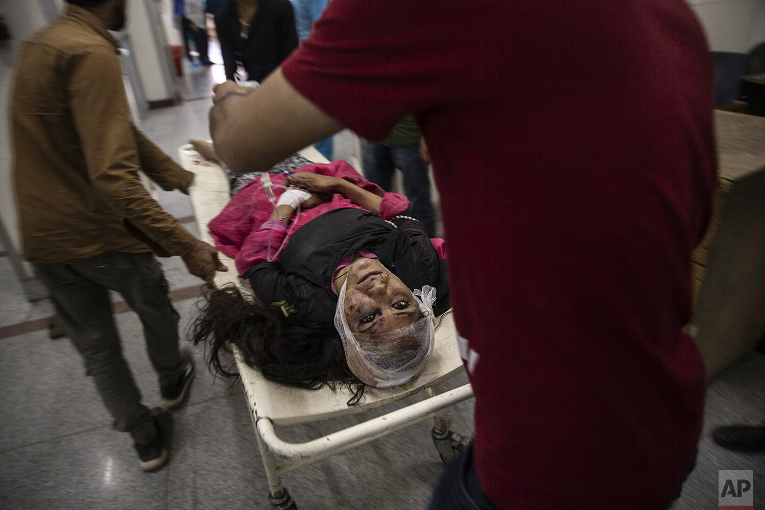  A wounded woman is carried on a stretcher for treatment after she was injured in a bus accident, at a local hospital in Srinagar, Indian controlled Kashmir, June 27, 2019. A minibus carrying students to a picnic fell into a gorge along a Himalayan r