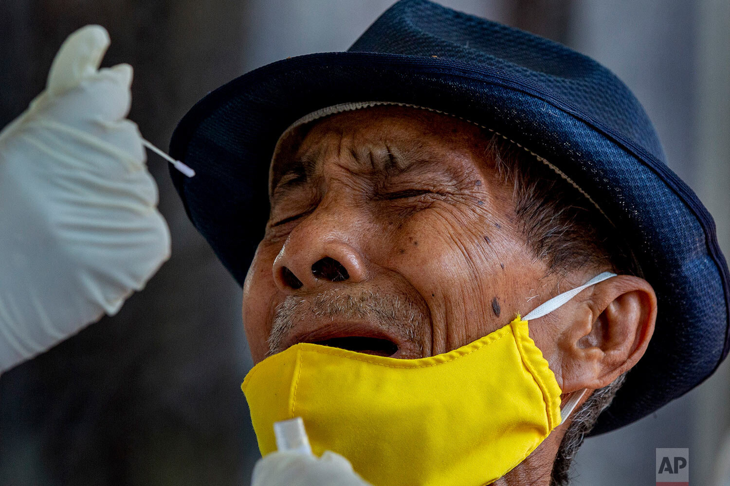  A man grimaces as a nasal swab sample is collected from him to test for COVID-19 in Bangkok, Thailand, Wednesday, May 6, 2020.  (AP Photo/Gemunu Amarasinghe) 