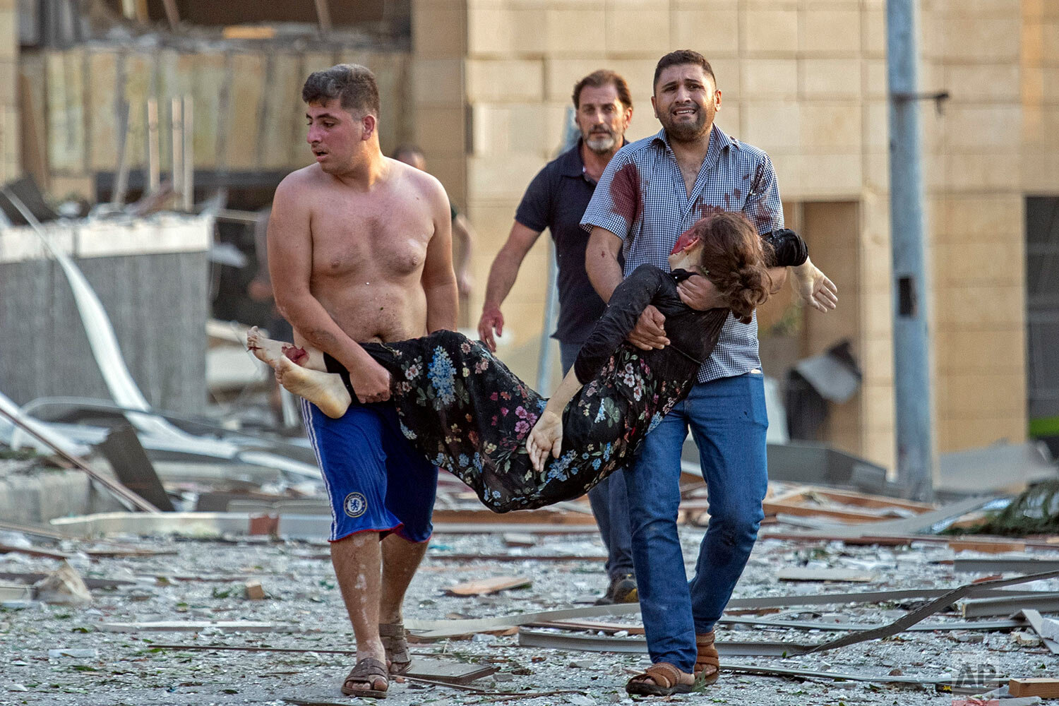  A wounded woman is evacuated after a massive explosion in Beirut, Lebanon, Tuesday, Aug. 4, 2020. (AP Photo/Hassan Ammar) 