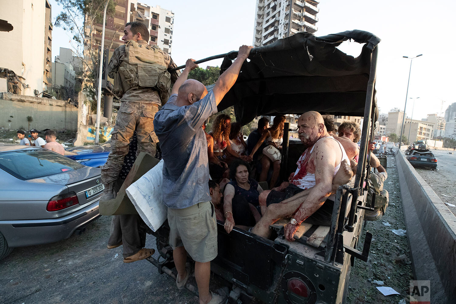  Injured people are evacuated after a massive explosion in Beirut, Lebanon, Tuesday, Aug. 4, 2020. (AP Photo/Hassan Ammar) 