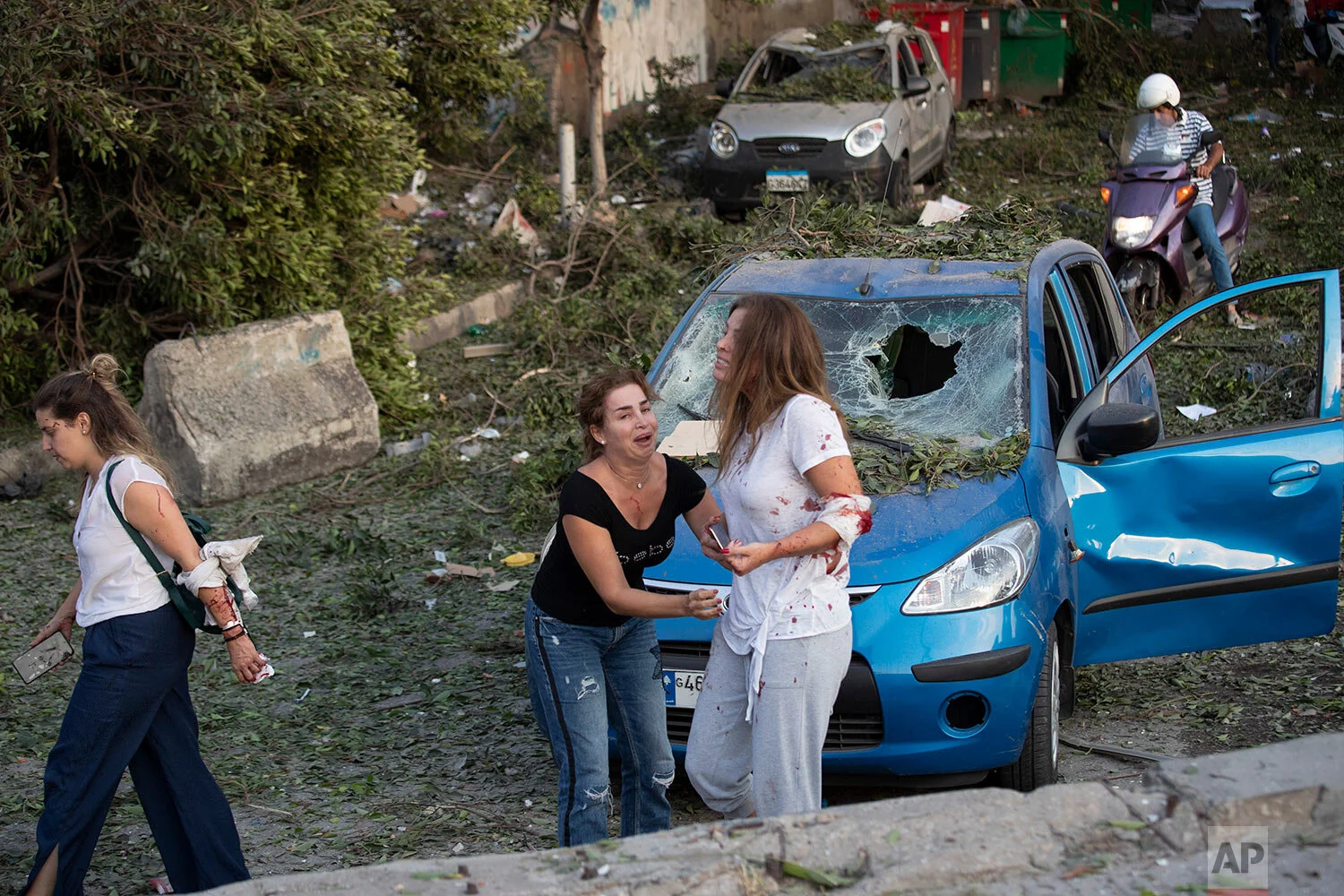 Terror, death, devastation in Lebanon explosion — AP Images Spotlight
