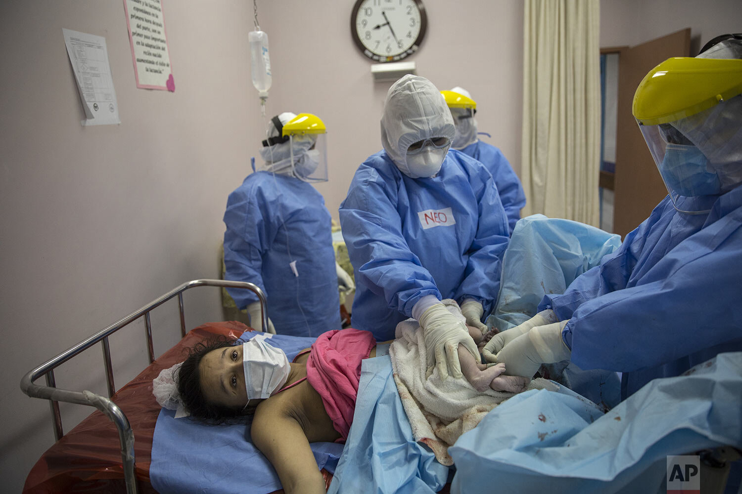  Maria Alvarez waits to be handed her newborn baby girl as an obstetrician and neonatologist clamp the baby’s umbilical cord, at the National Maternal Perinatal Institute in Lima, Peru, Wednesday, July 29, 2020. (AP Photo/Rodrigo Abd) 
