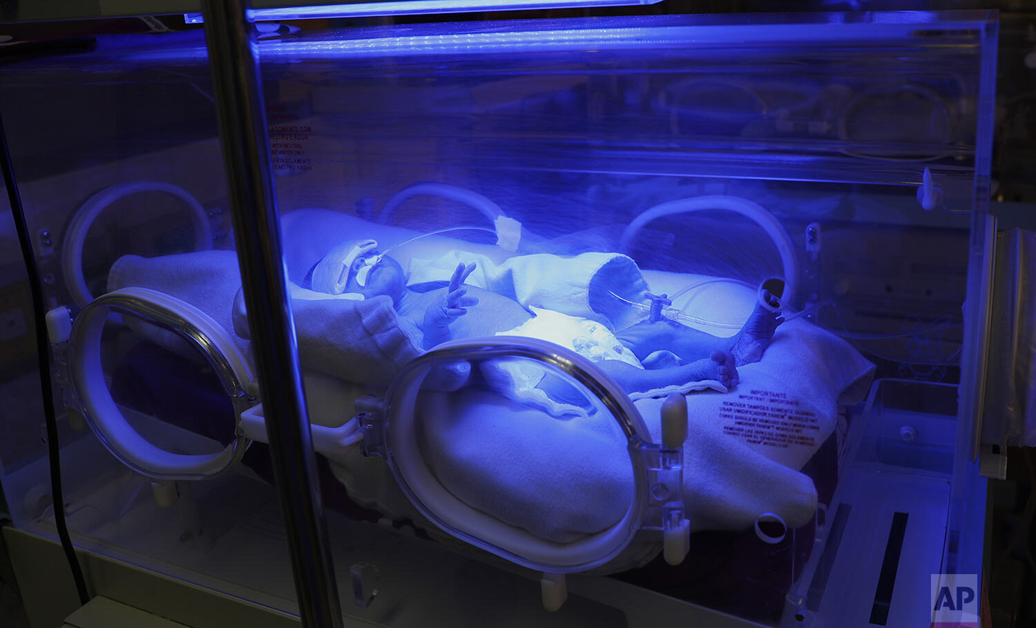  A newborn baby receives oxygen in an incubator in ICU of the Women's Hospital maternity ward in La Paz, Bolivia, Aug. 13, 2020, where doctors say the oxygen supplies for babies is becoming scarce due to protesters’ roadblocks against the postponemen