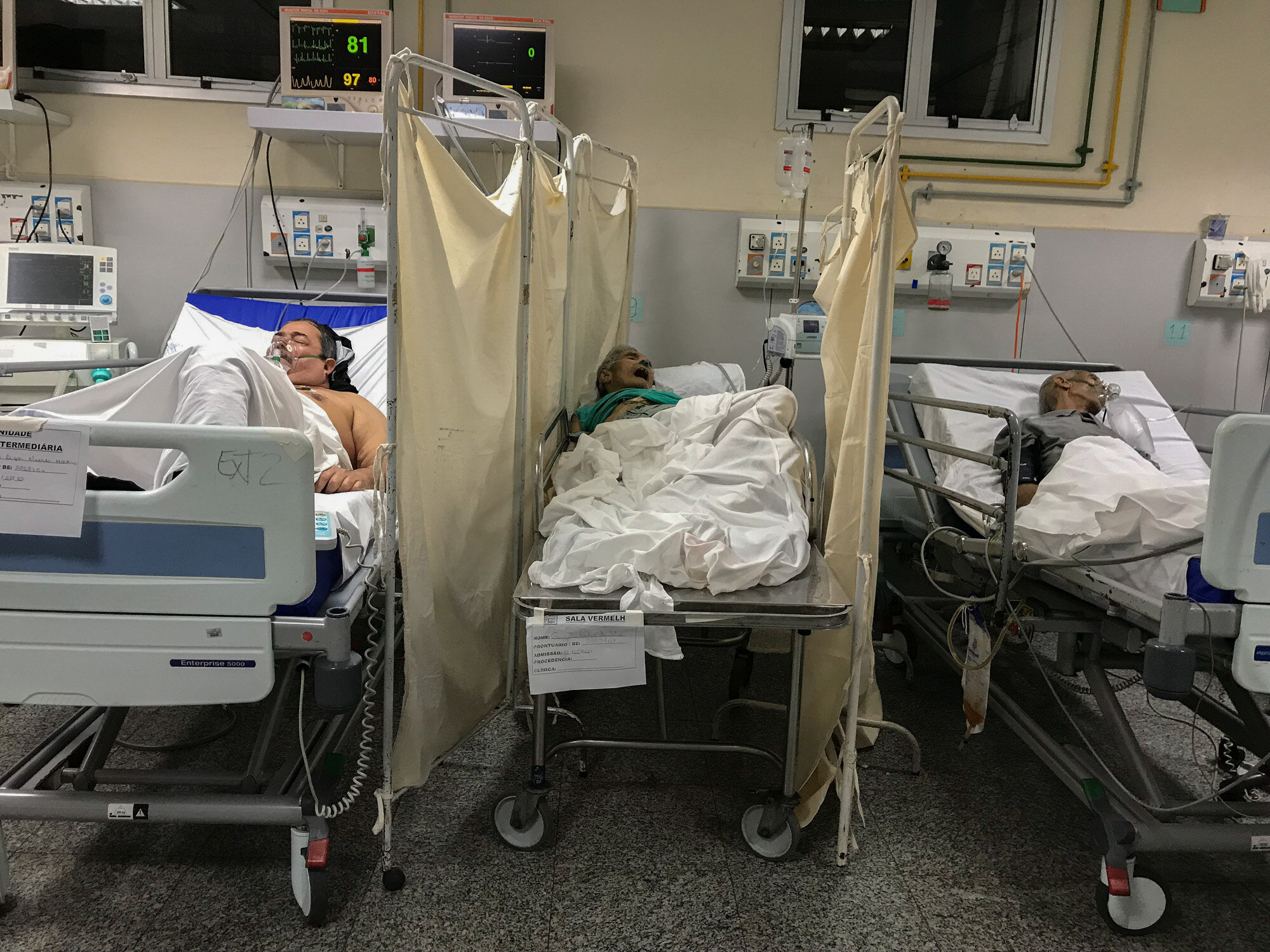 A patient who died from COVID-19 lies on a table between two other patients infected with the coronavirus at the Salgado Filho Municipal Hospital in Rio de Janeiro, Brazil, on May 24, 2020. (AP Photo/Leo Correa)