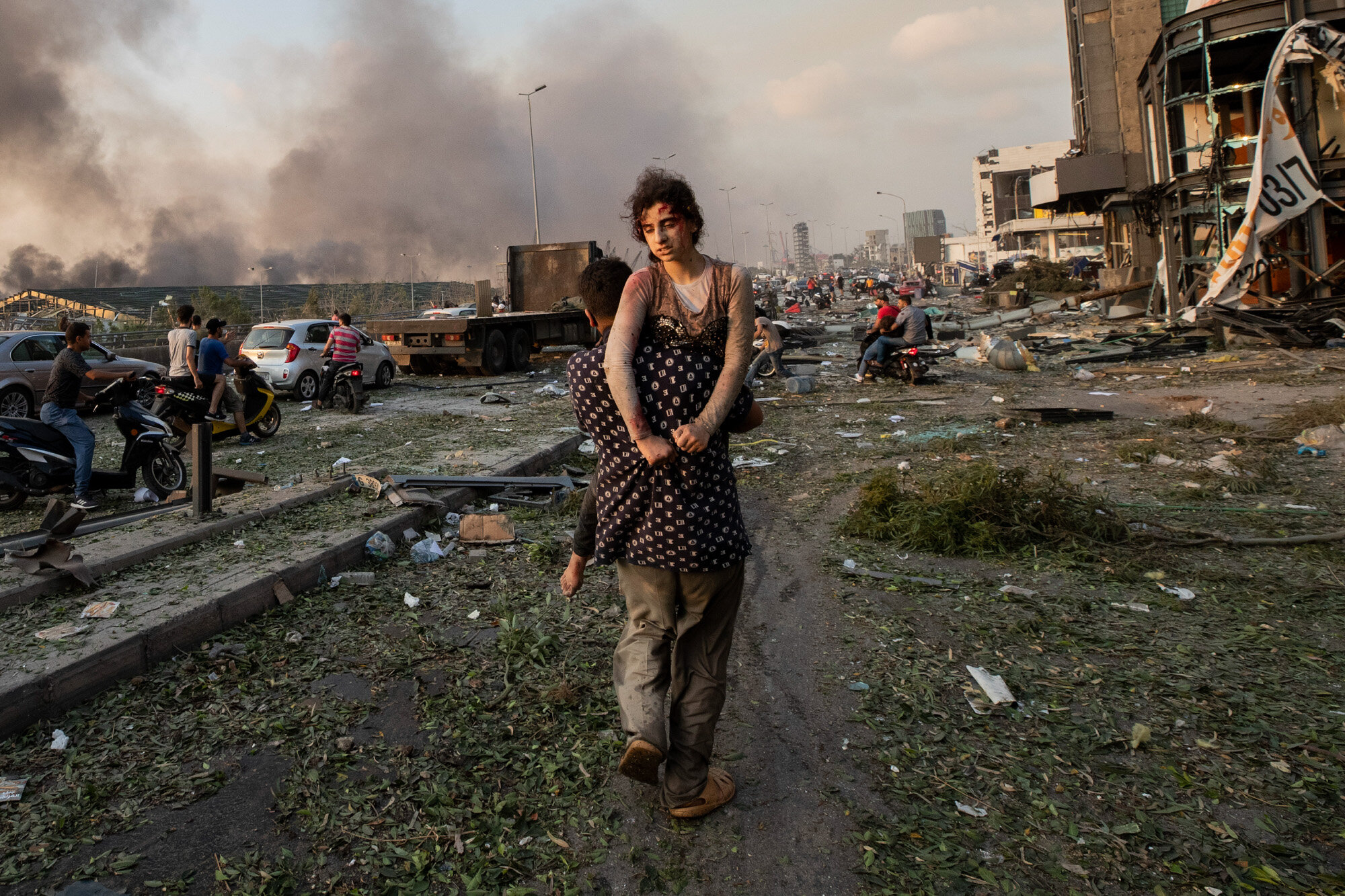 Hoda Kinno, 11, is evacuated by her uncle Mustafa on Aug. 4, 2020, shortly after a massive explosion at the port in Beirut, Lebanon. The Kinno family from Syria's Aleppo region was devastated in the wake of the explosion — Hoda suffered a broken neck and other injuries and her sister Sedra, 15, died in the explosion. (AP Photo/Hassan Ammar)