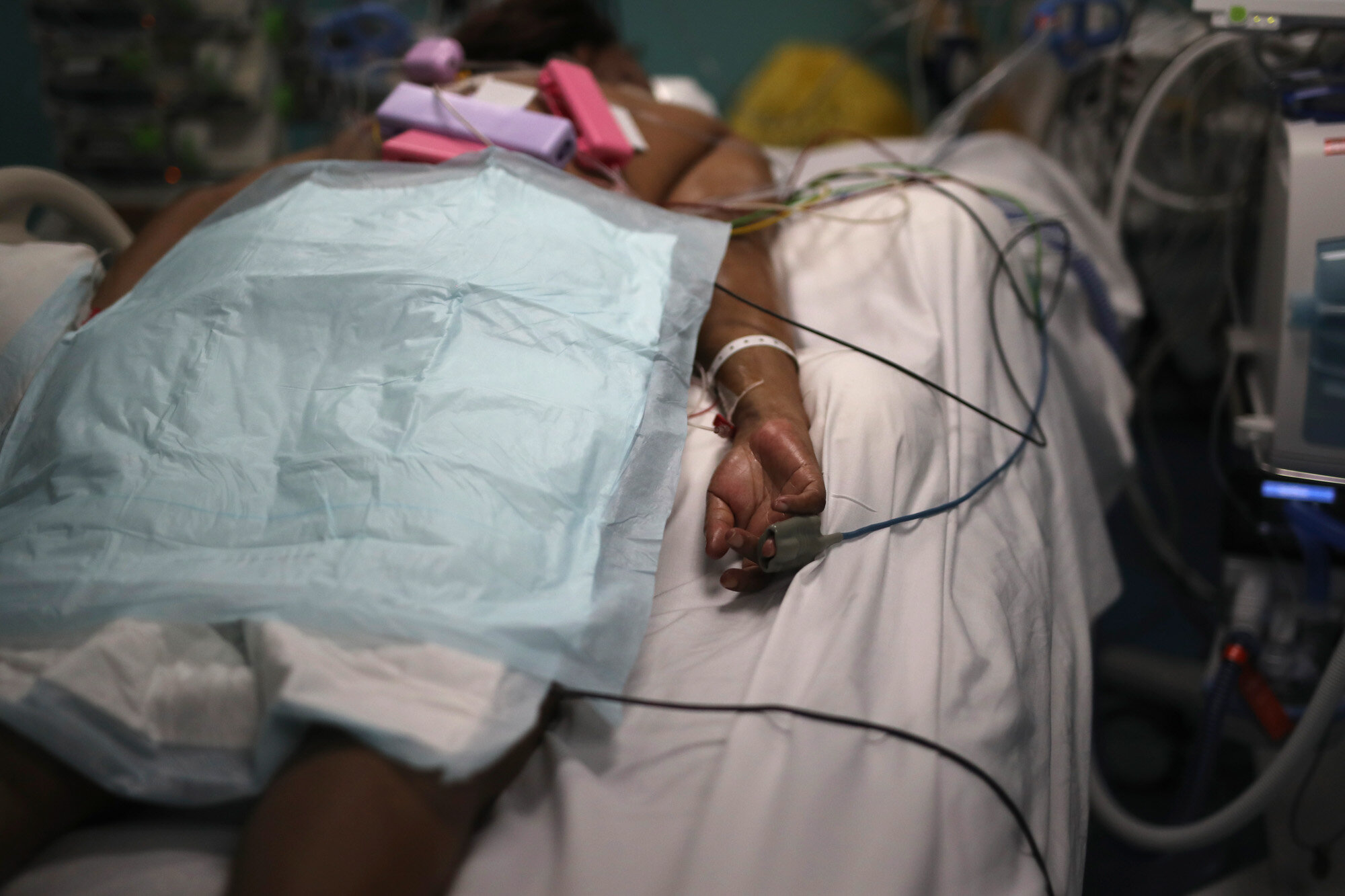 A patient afflicted with COVID-19 lies on a bed in a hospital in Marseille, France, on Sept.10, 2020. (AP Photo/Daniel Cole)