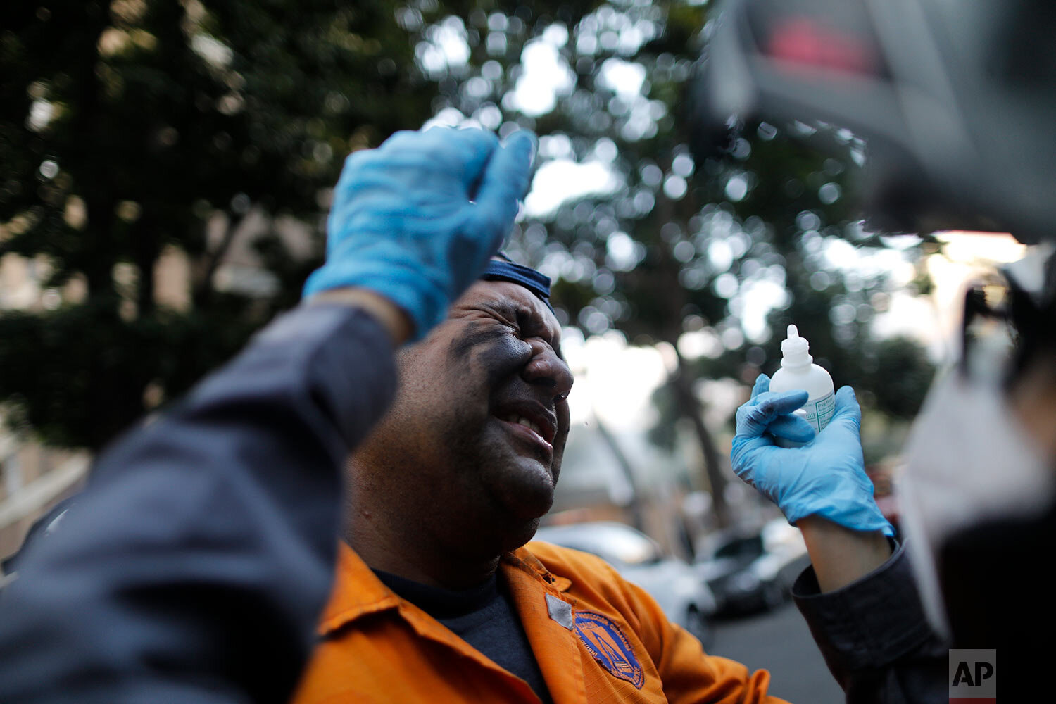  A civil defense worker grimaces as Angels of the Road paramedic volunteer Zully Rodiz applies drops on his eyes after a car fire at a parking lot in Caracas, Venezuela, Monday, Feb. 8, 2021. (AP Photo/Ariana Cubillos) 