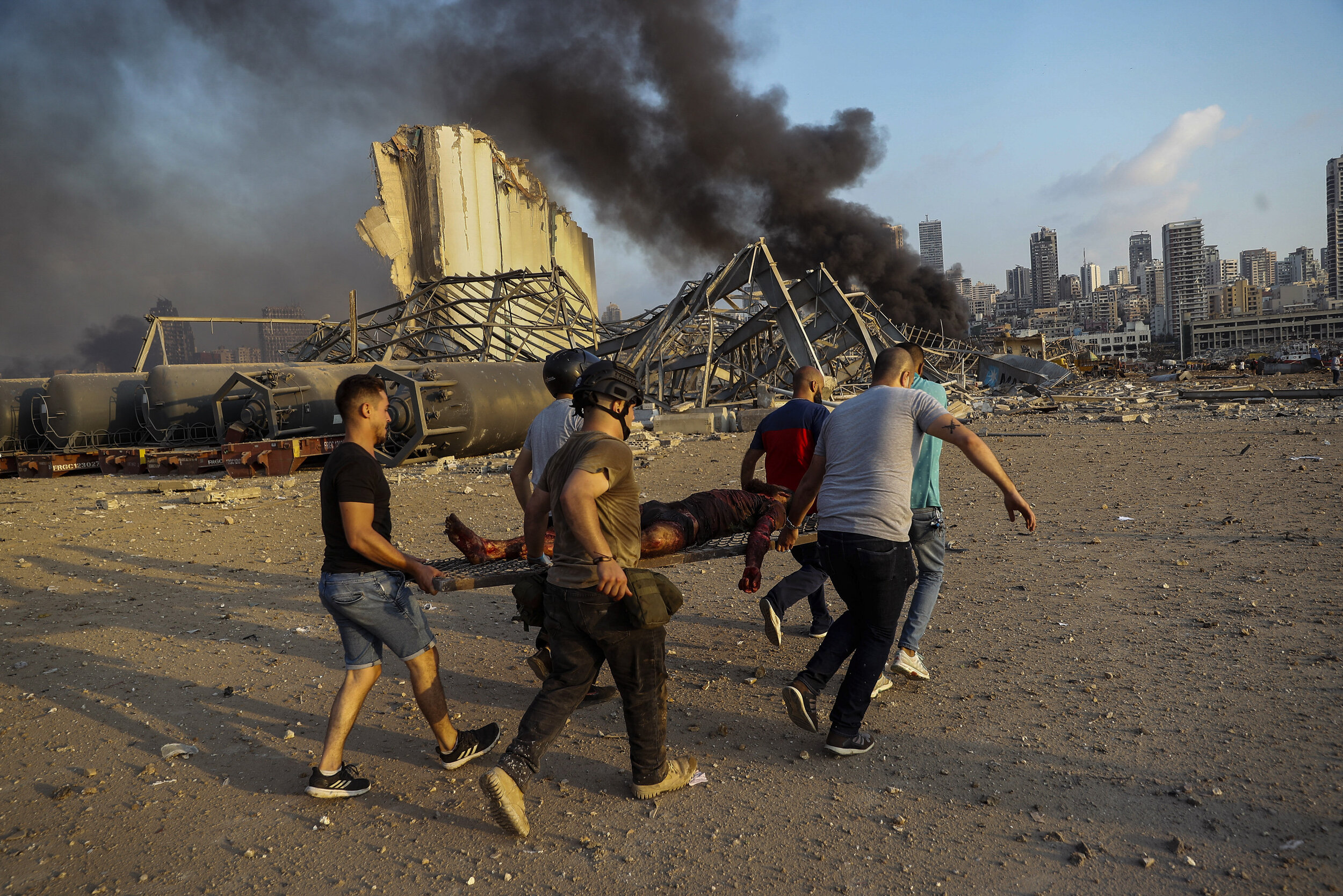  Civilians carry a victim at the explosion scene that hit the seaport in Beirut, Lebanon, Aug. 4, 2020. (AP Photo/Hussein Malla) 