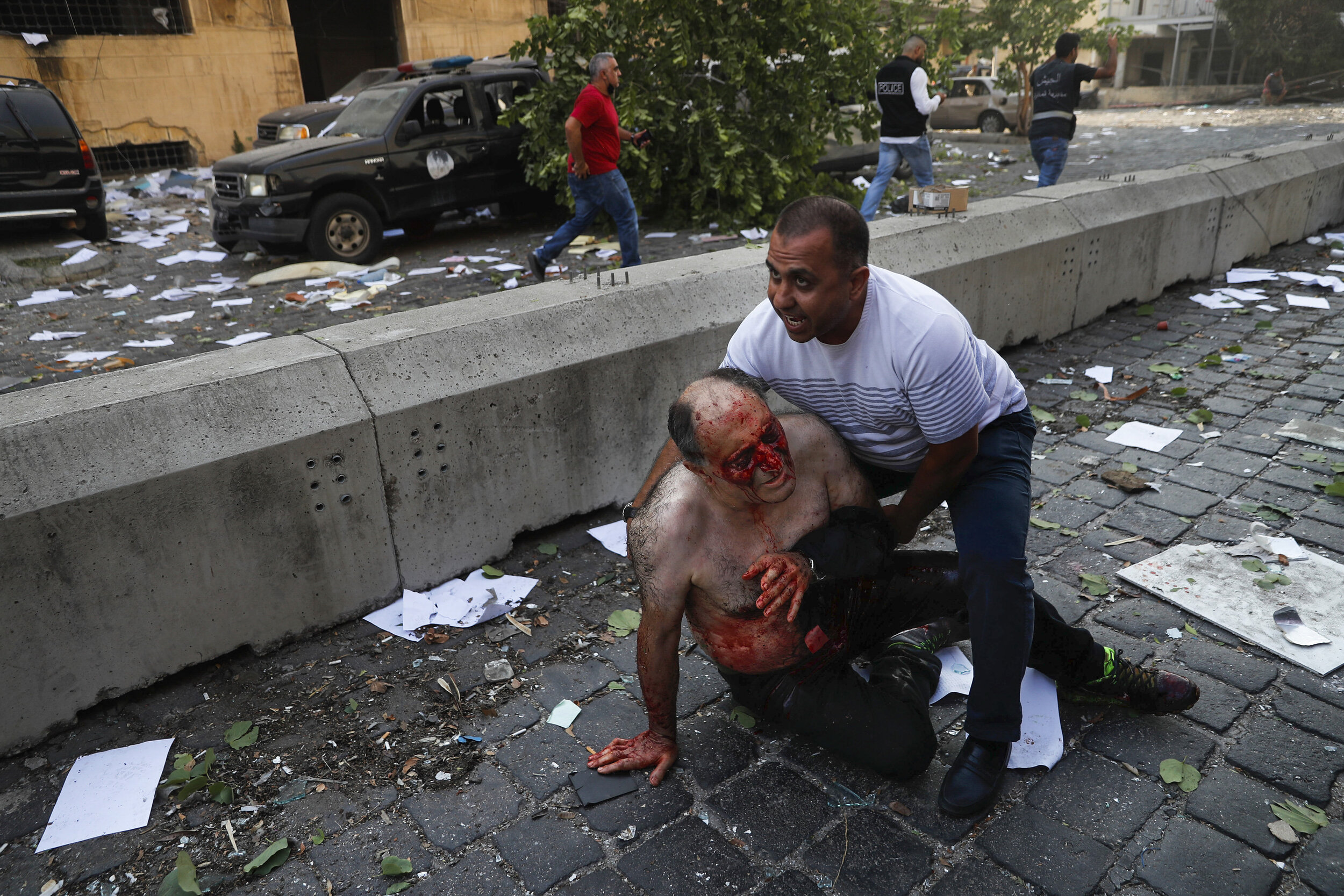  A Lebanese man helps an injured man who was wounded by an explosion that hit the seaport of Beirut, Lebanon, Aug. 4, 2020. (AP Photo/Hussein Malla) 