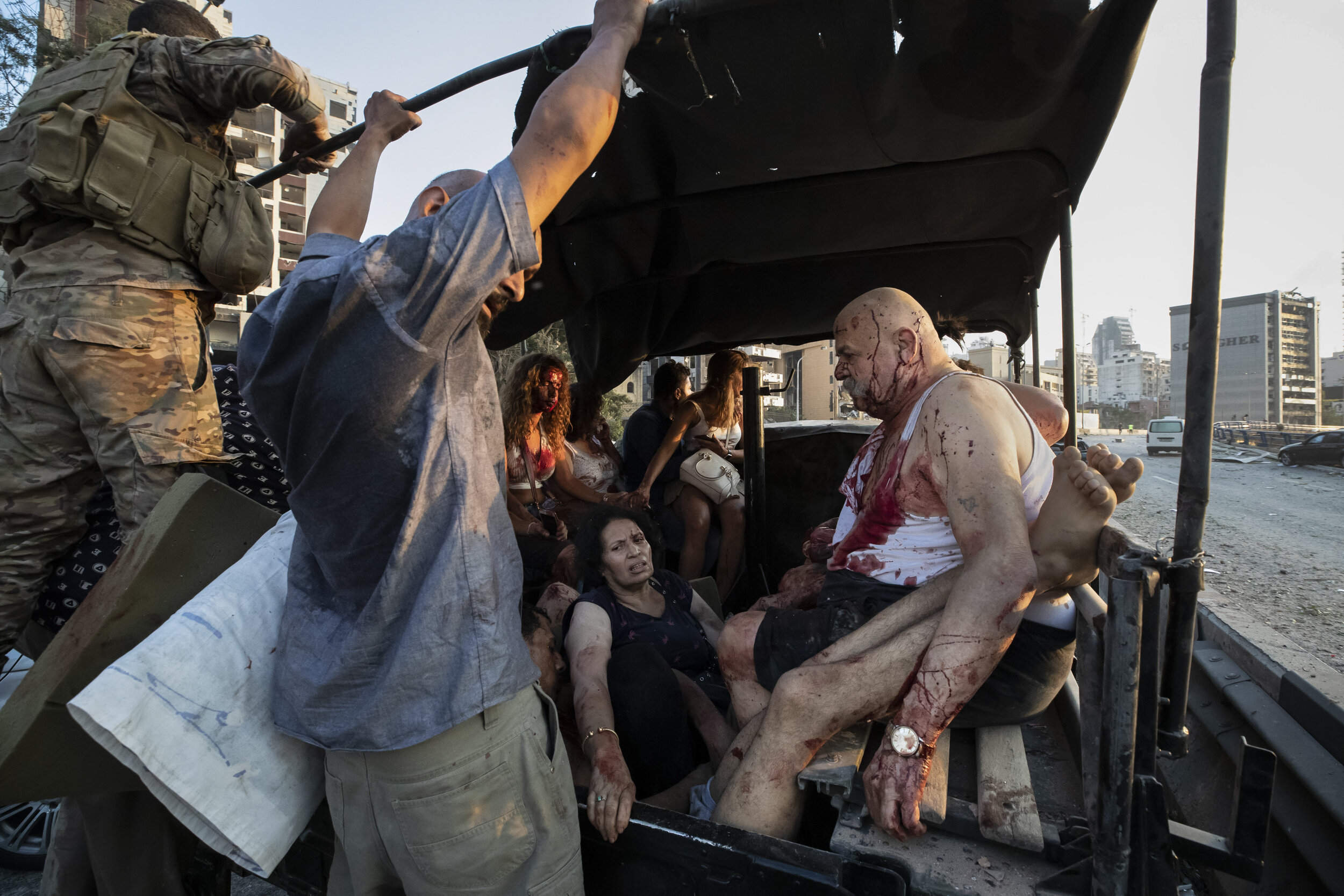  Injrued are evacuated after a massive explosion in Beirut, Lebanon, Aug. 4, 2020. (AP Photo/Hassan Ammar) 