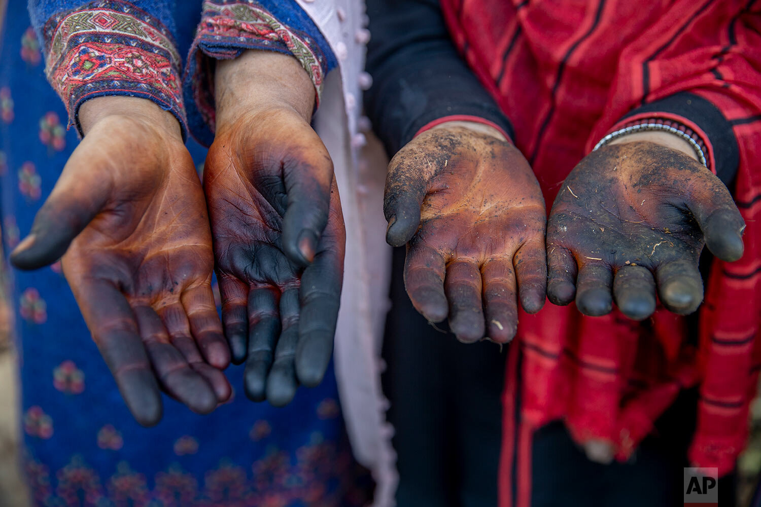  Kashmiri villagers show their hands stained by cleaning and shelling walnuts in Budgham area, northeast of Srinagar, Saturday, Sept. 25, 2021. (AP Photo/Dar Yasin) 