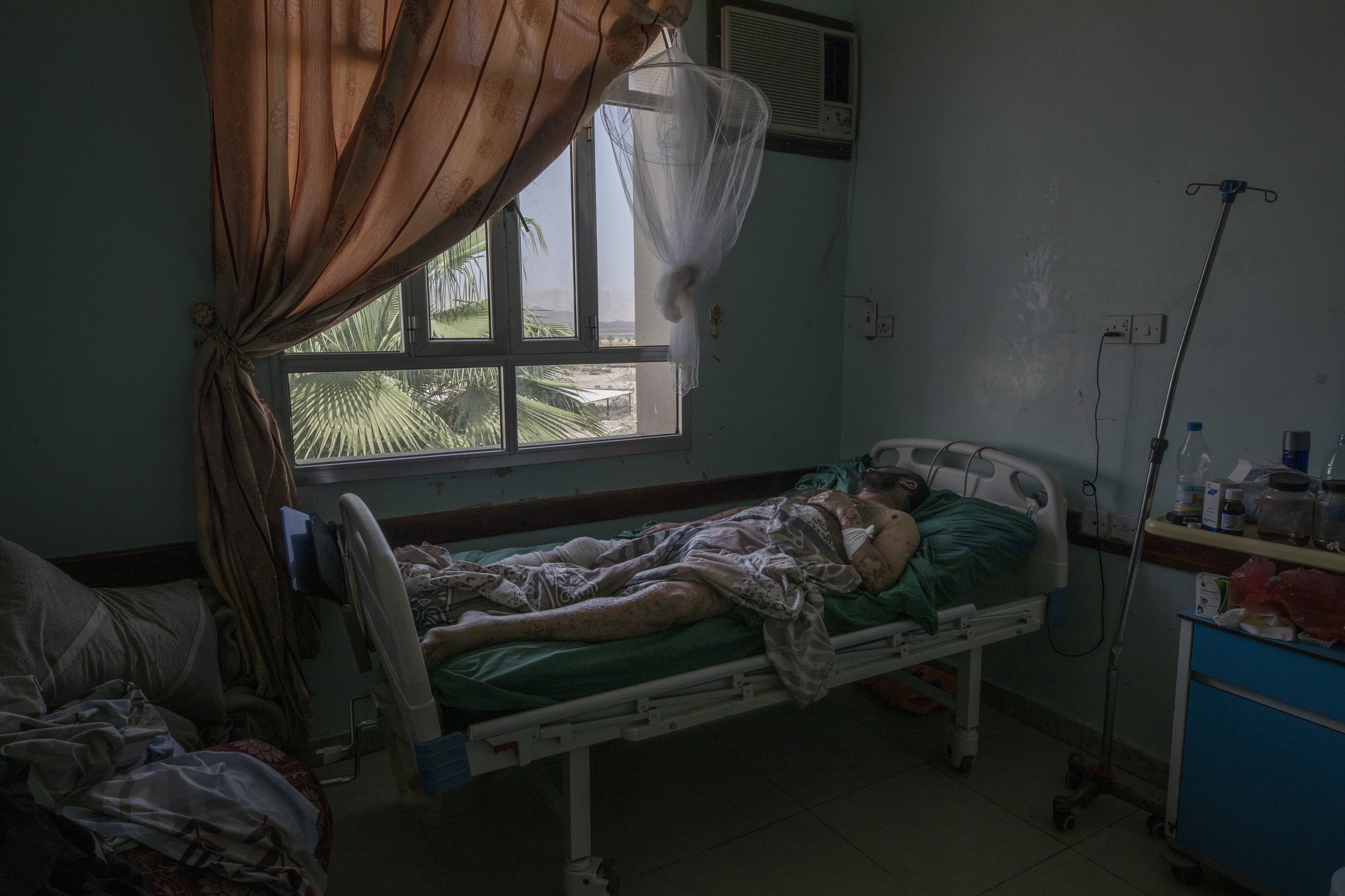  A Yemeni man who was severely injured when a ballistic missile and an explosive-laden drone fired by Yemen's Houthi rebels hit a fuel station in the Rawdha neighborhood of Marib, Yemen, receives treatment at a hospital in Marib, on June 21, 2021. (A