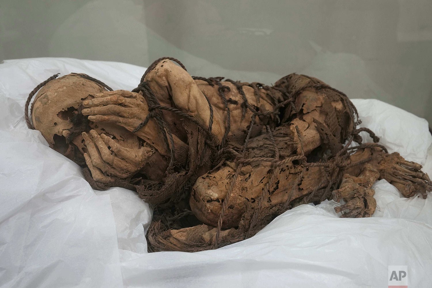  A mummy from 800-1200 AD is displayed at San Marcos University in Lima, Peru, Dec. 7, 2021. According to archeologists, the mummy was buried with its hands covering its face and wrapped with rope in Cajamarquilla. (AP Photo/Martin Mejia) 