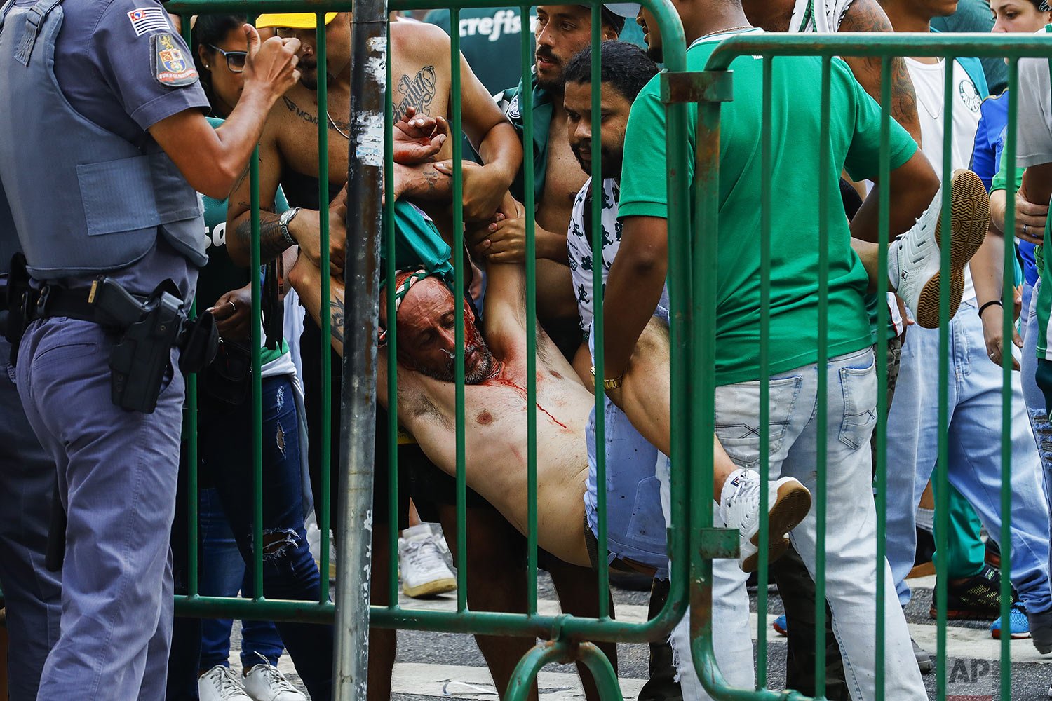  An injured Palmeiras soccer fan is carried after clashes that broke out while fans watched a live broadcast, from Abu Dhabi, of their team’s FIFA Club World Cup final soccer match against Chelsea, in Sao Paulo, Brazil, Feb. 12, 2022. (AP Photo/Marce