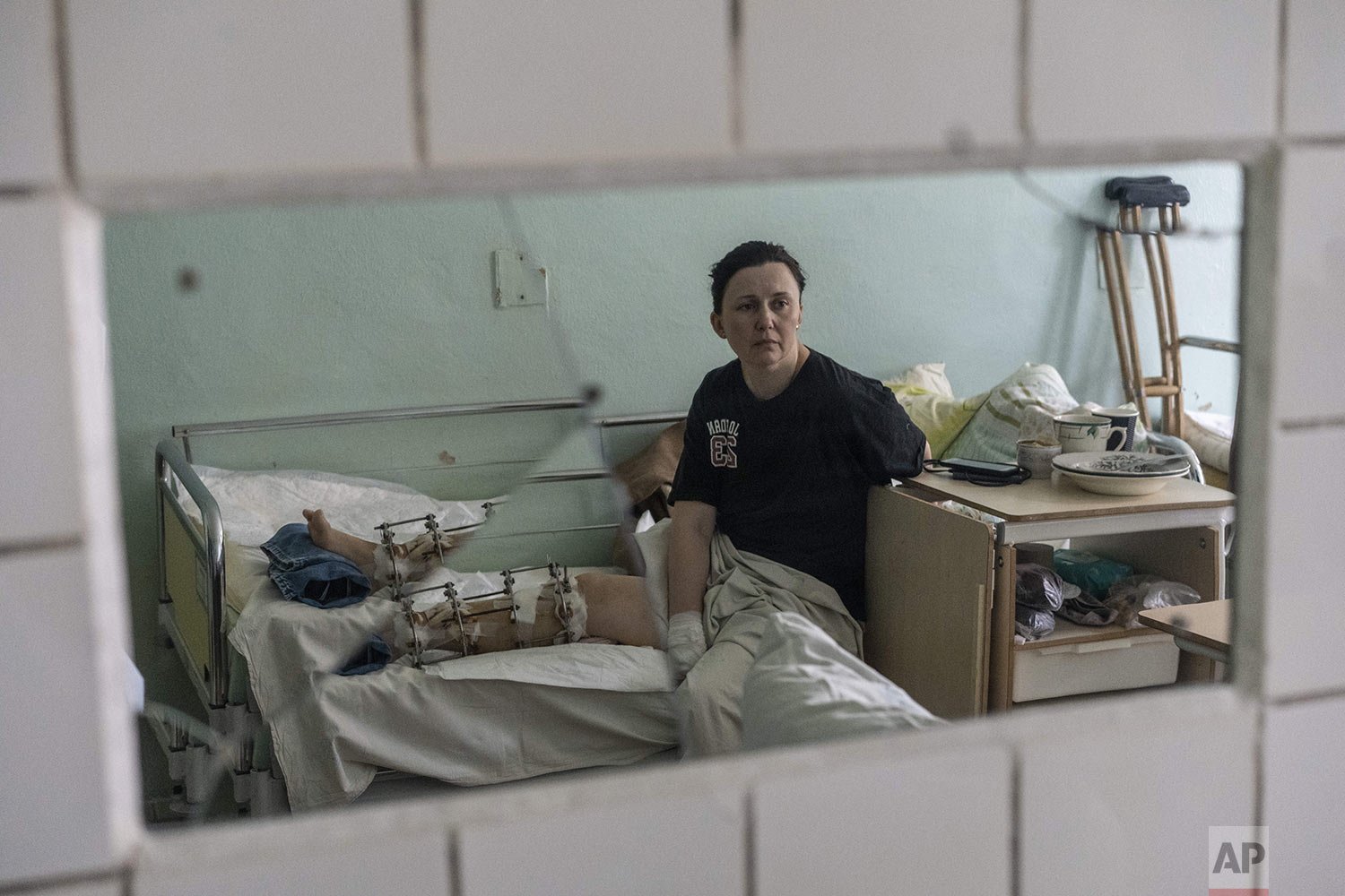  Natalya Vakula, 44, rests in a hospital in Brovary, on the outskirts of Kyiv, while recovering from injuries in her leg after a Russian attack in Chernihiv, Ukraine, Saturday, March 26, 2022. (AP Photo/Rodrigo Abd) 