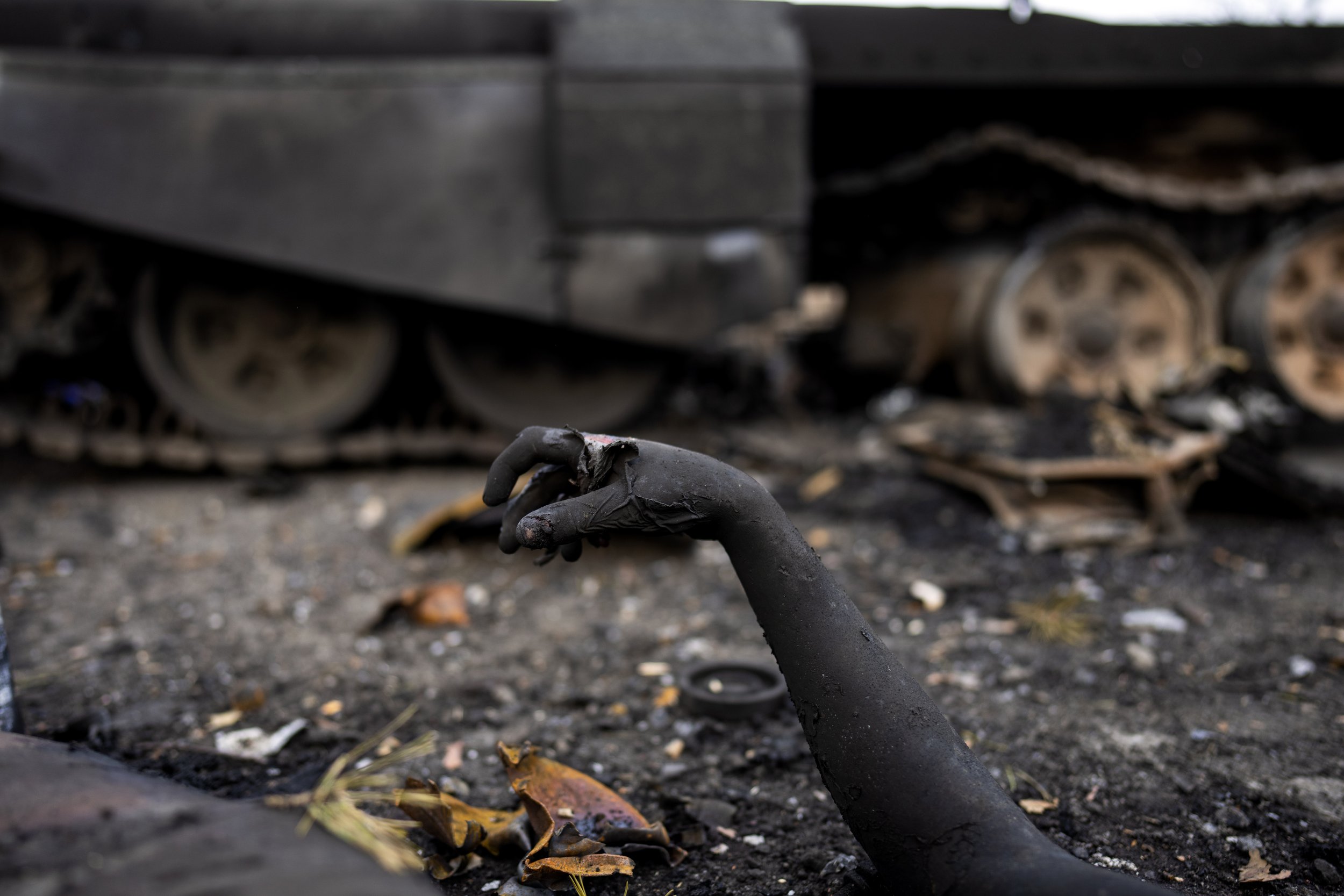  The arm of a dead Russian soldier is seen next to a tank on the outskirts of Kyiv, Ukraine, Thursday, March 31, 2022. (AP Photo/Rodrigo Abd) 
