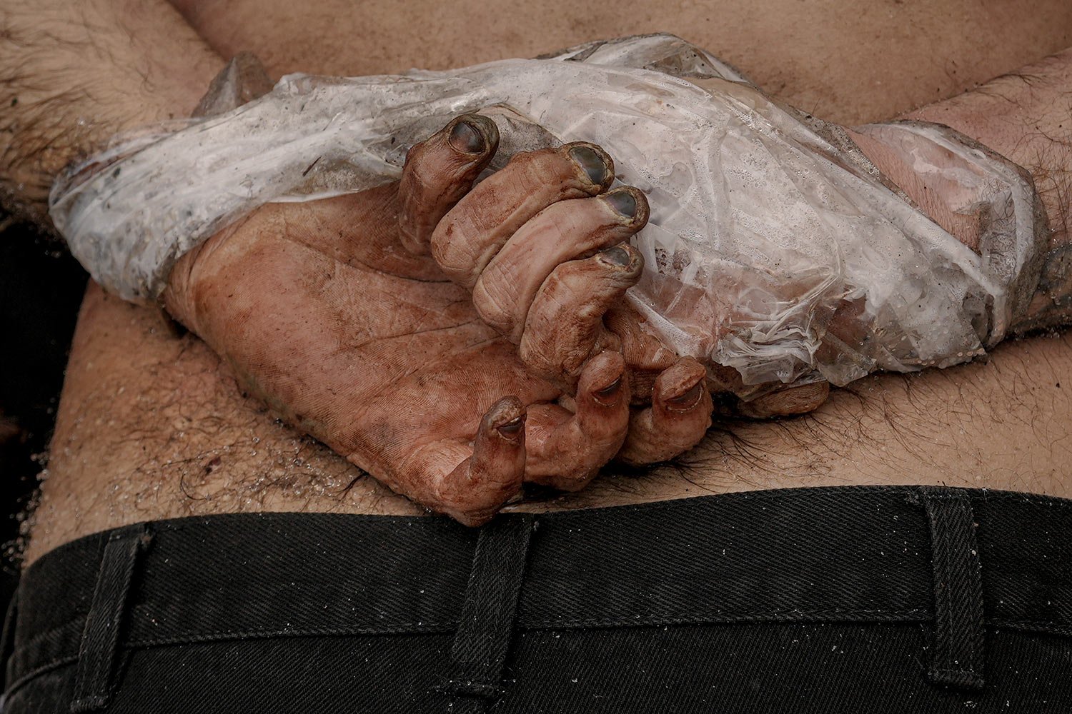  A dead body of a man with his hands tied behind his back lies on the pavement in Bucha, Ukraine, Sunday, April 3, 2022. (AP Photo/Vadim Ghirda) 