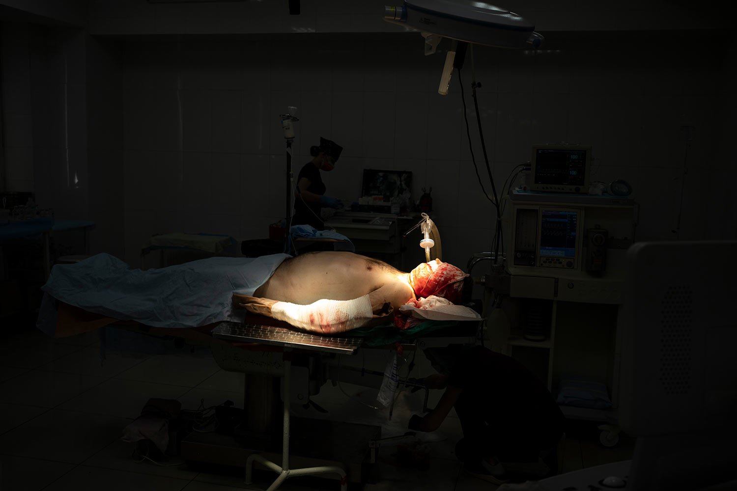  A Ukrainian soldier lies on the operating table  before surgery after being injured as Russian attacks continue in Kharkiv, Ukraine, Friday, March 25, 2022. (AP Photo/Felipe Dana)  