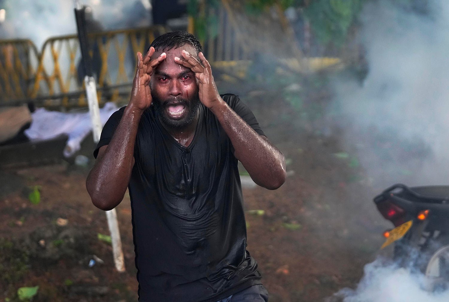  An injured protestor screams in pain as police fire tear gas to disperse protesting members of the Inter University Students Federation during an anti government protest in Colombo, Sri Lanka, Thursday, May 19, 2022. (AP Photo/Eranga Jayawardena) 