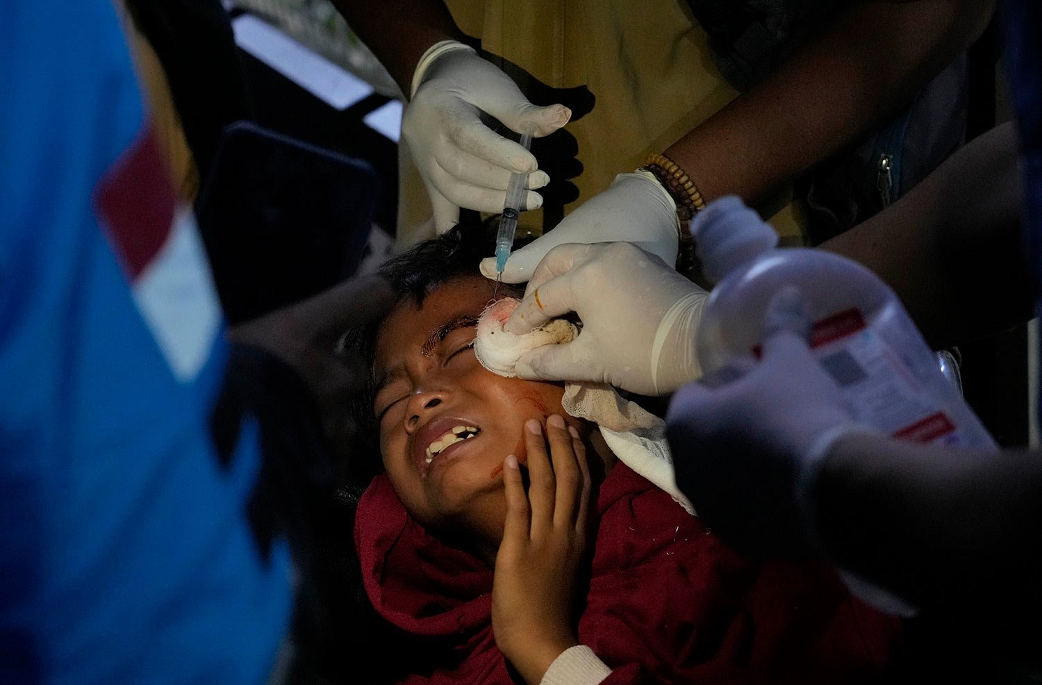  A young earthquake survivor receives medical treatment at a makeshift hospital in Cianjur, West Java, Indonesia, Monday, Nov. 21, 2022.  (AP Photo/Tatan Syuflana) 