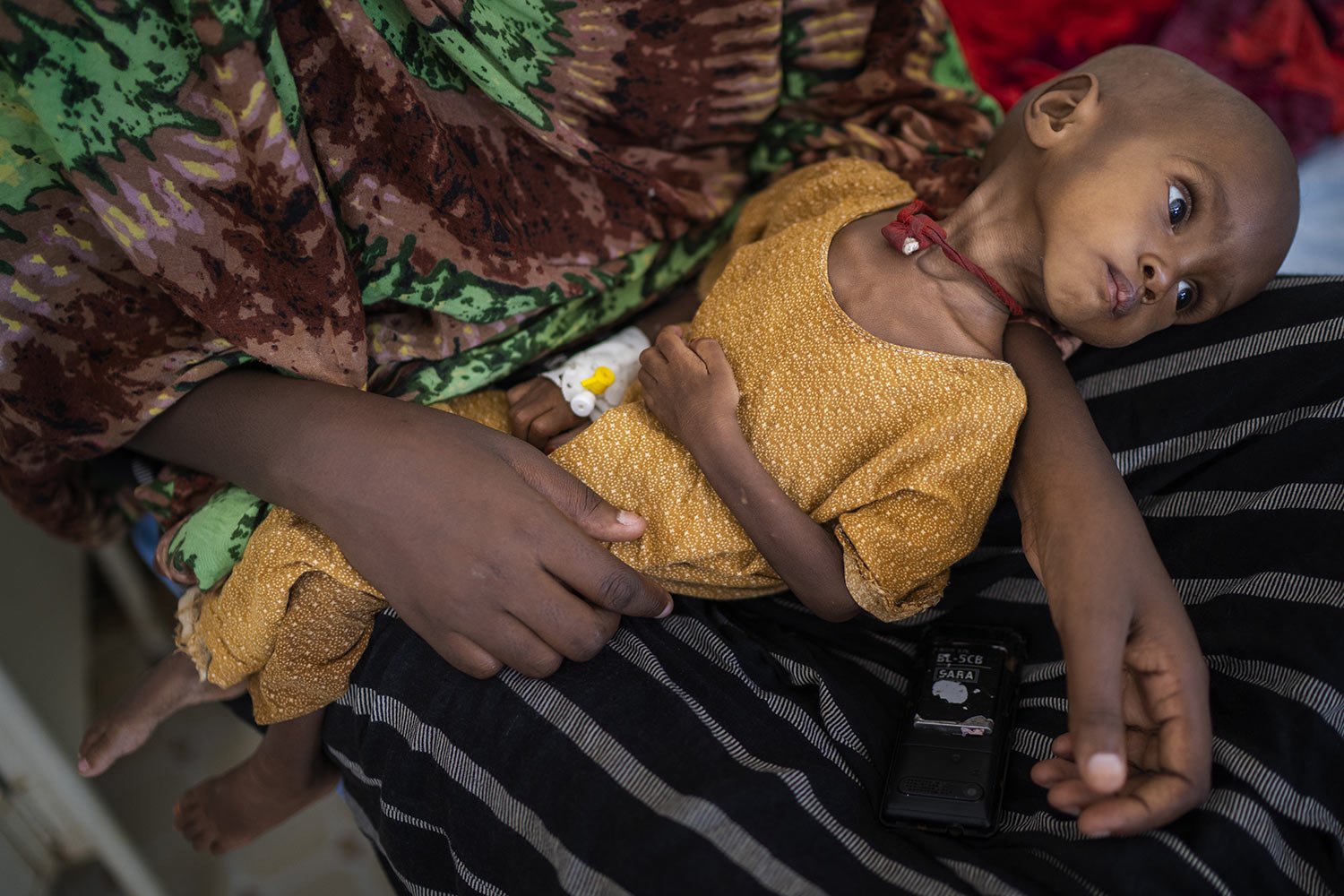  Hamdi Yusuf, a malnourished child, is held by her mother in Dollow, Somalia, Sept. 21, 2022. Yusuf was little more than skin and bones when her mother found her unconscious, two months after arriving in the camps and living on scraps of food offered