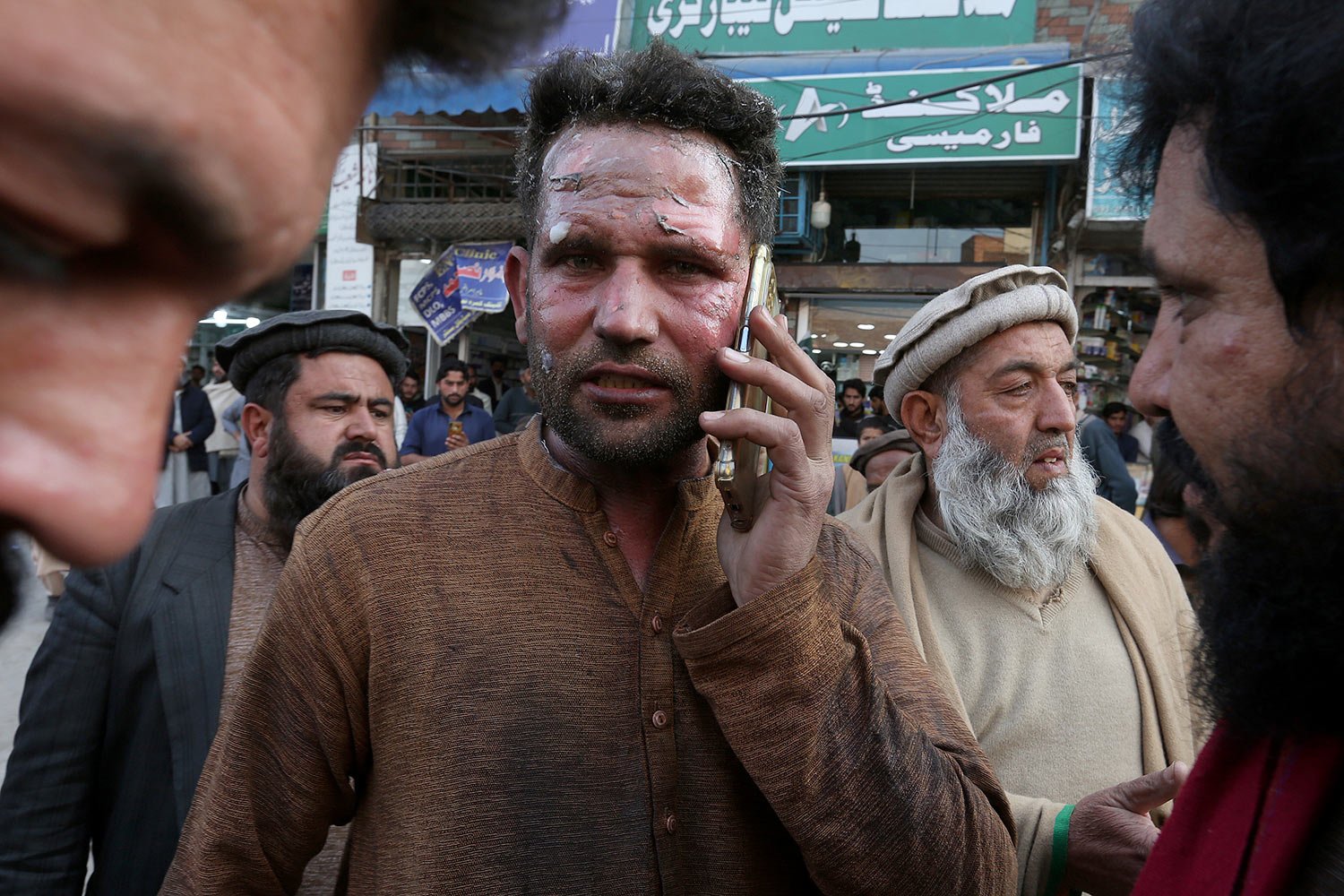  An injured victim of a suicide bombing talks on his mobile phone after getting initial treatment outside a hospital in Peshawar, Pakistan, Monday, Jan. 30, 2023.  (AP Photo/Muhammad Sajjad) 