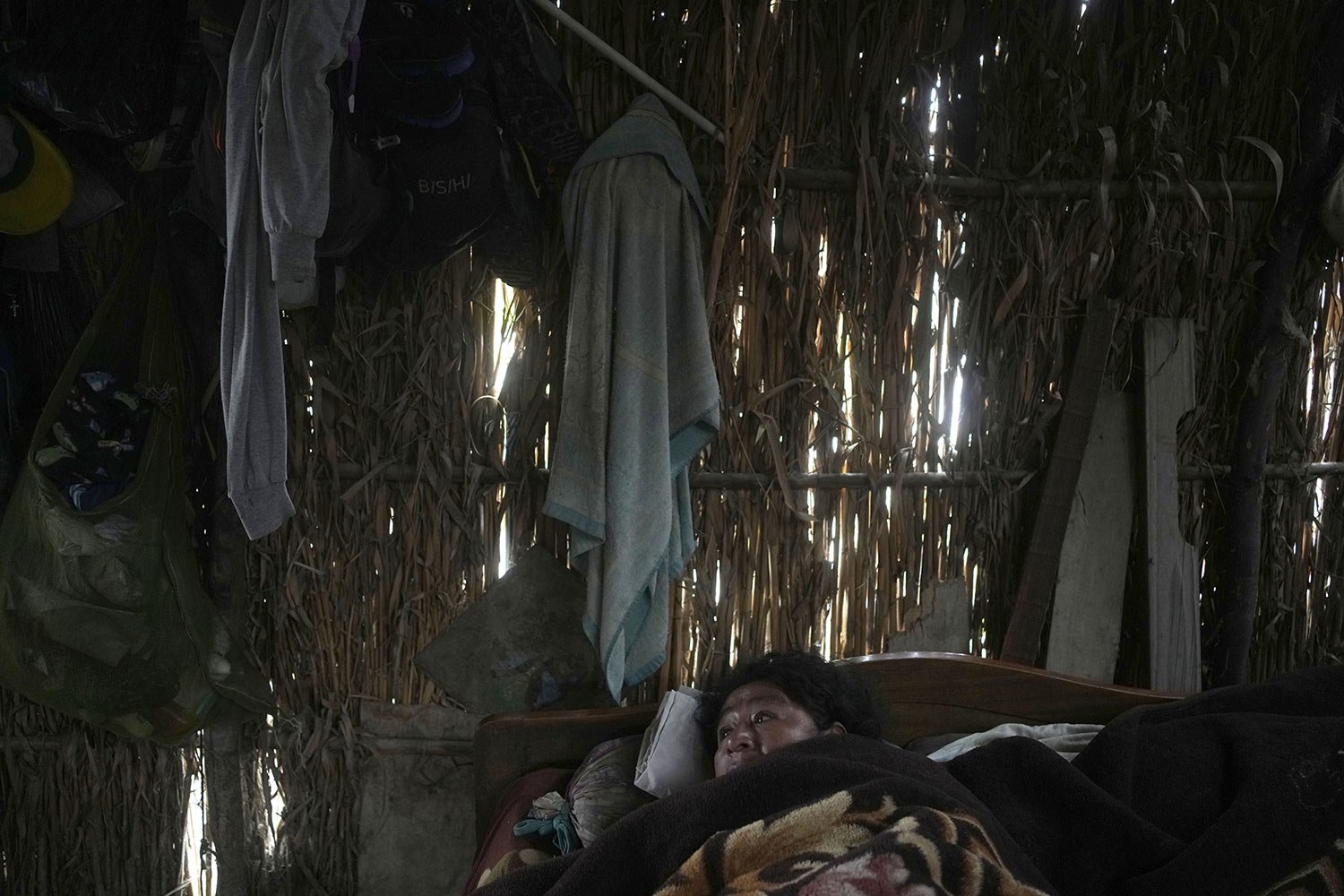  Dengue patients Maria Galan, 47, lies in her bed at the San Pablo low-income neighborhood in Piura, Peru, June 4, 2023. Dengue, a viral disease transmitted by a mosquito, causes flu-like symptoms, such as muscle pain and fever. (AP Photo/Martin Meji