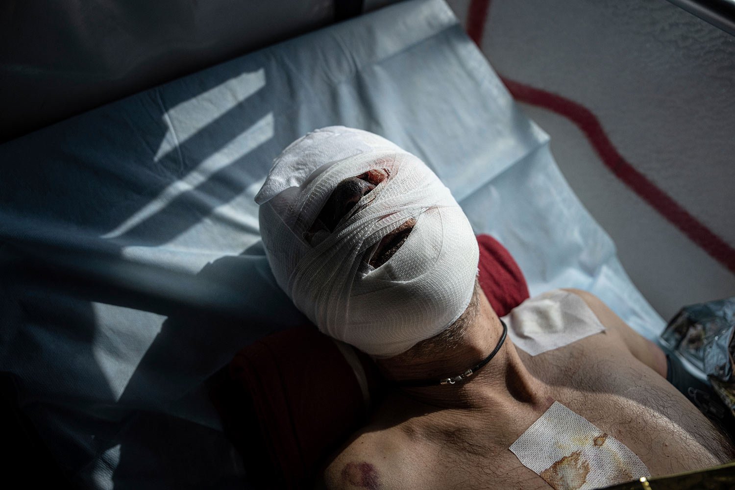  An injured Ukrainian soldier lies on a bed inside a special medical bus during an evacuation by volunteers from the Hospitallers paramedic organisation in Donetsk region, Ukraine, Wednesday, March 22, 2023. (AP Photo/Evgeniy Maloletka) 