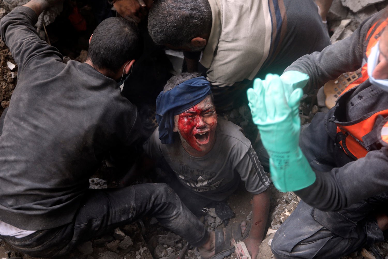  An injured Palestinian boy cries as rescuers try to pull him out of the rubble of a destroyed building following an Israeli airstrike in Bureij refugee camp, Gaza Strip, Thursday, Nov. 2, 2023. (AP Photo/Mohammed Dahman) 