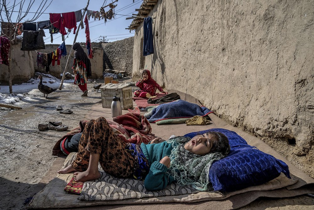  A sick and disabled girl lies in the open air in the yard, in a camp for internally displaced families on the outskirts of Kabul, Afghanistan, Feb 6, 2023. Her mother has no money to treat her sick child.  (AP Photo/Ebrahim Noroozi) 