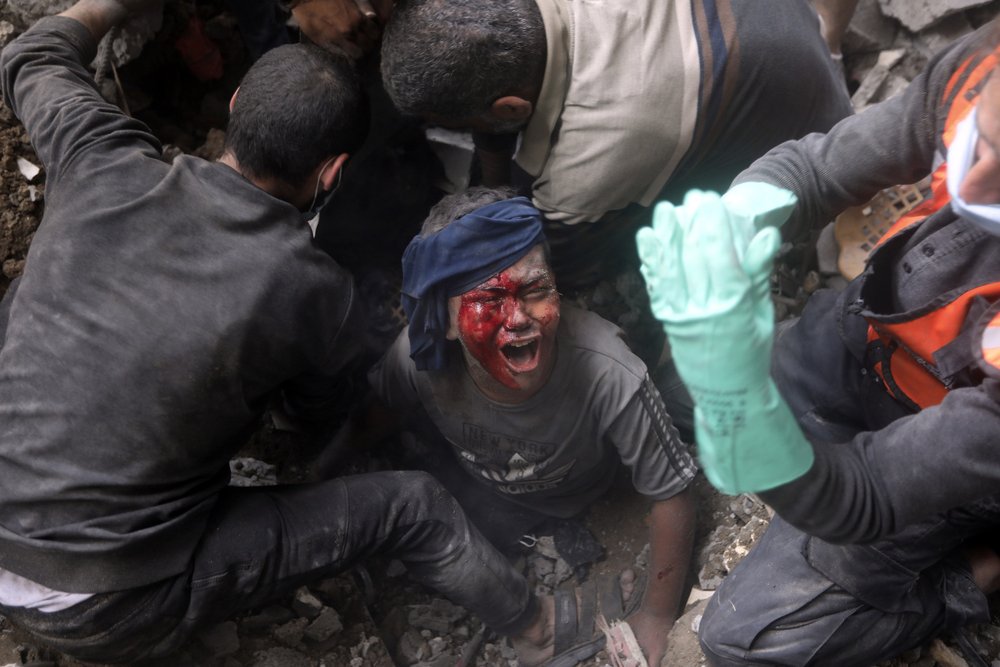  An injured Palestinian boy cries as rescuers try to pull him from the rubble of a destroyed building following an Israeli airstrike in Bureij refugee camp, Gaza Strip, Thursday, Nov. 2, 2023. Photo by Mohammed Dahman 