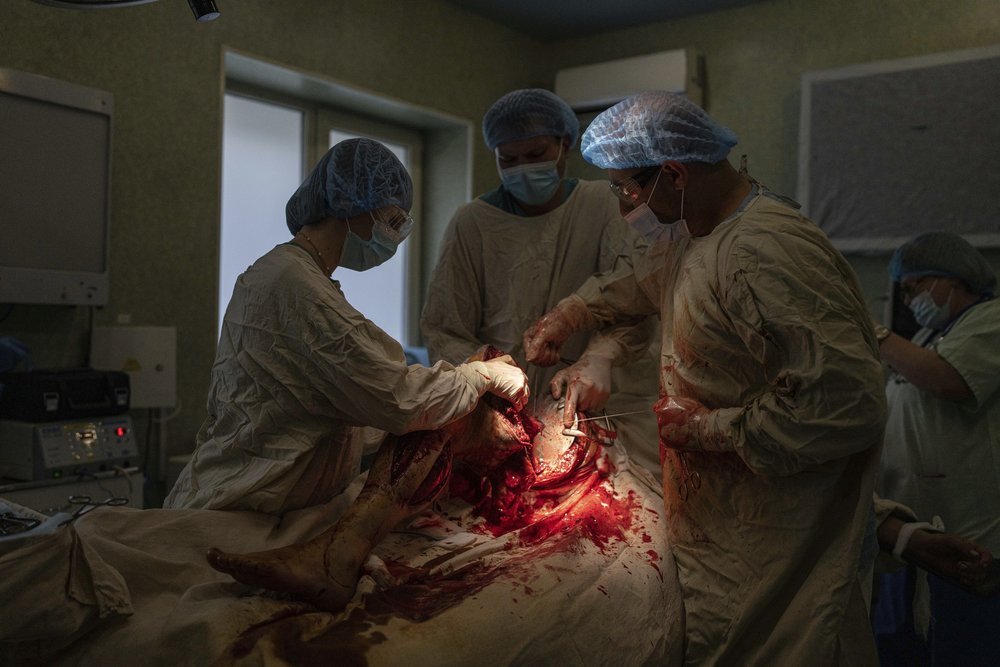  Surgeons amputate the leg of a wounded Ukrainian serviceman at Mechnikov Hospital in Dnipro, Ukraine, Friday, July 14, 2023. A surge of wounded soldiers has coincided with the major counteroffensive Ukraine launched last month to try to recapture it