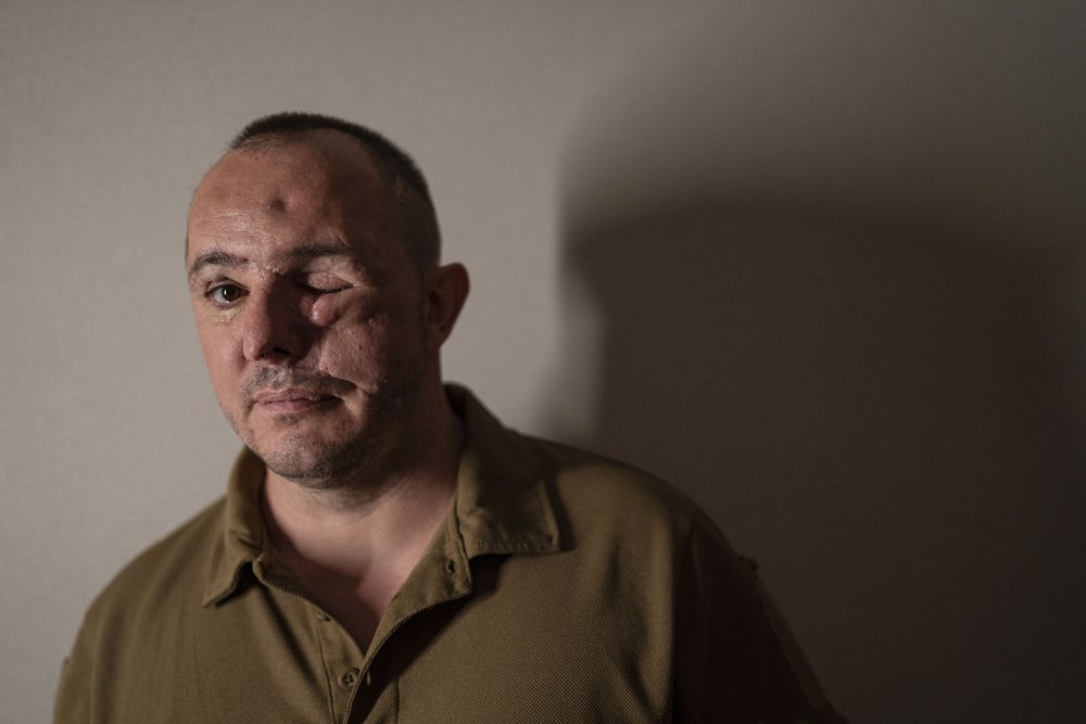  Roman Belinskiy, a 43-year-old Ukrainian army veteran, poses for a photo at home in Kolomyia, Ukraine, Friday, July 21, 2023. Belinsky, a stormtrooper from the 14th brigade, fought near Kyiv and then in the Zaporizhzhia region. Ukraine is facing the