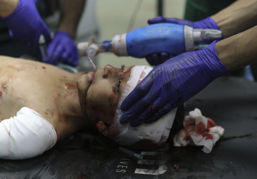  A wounded Palestinian child receives medical treatment at the Nasser Hospital following Israeli bombardment on Khan Younis refugee camp, southern Gaza Strip, Monday, Nov. 20, 2023.  