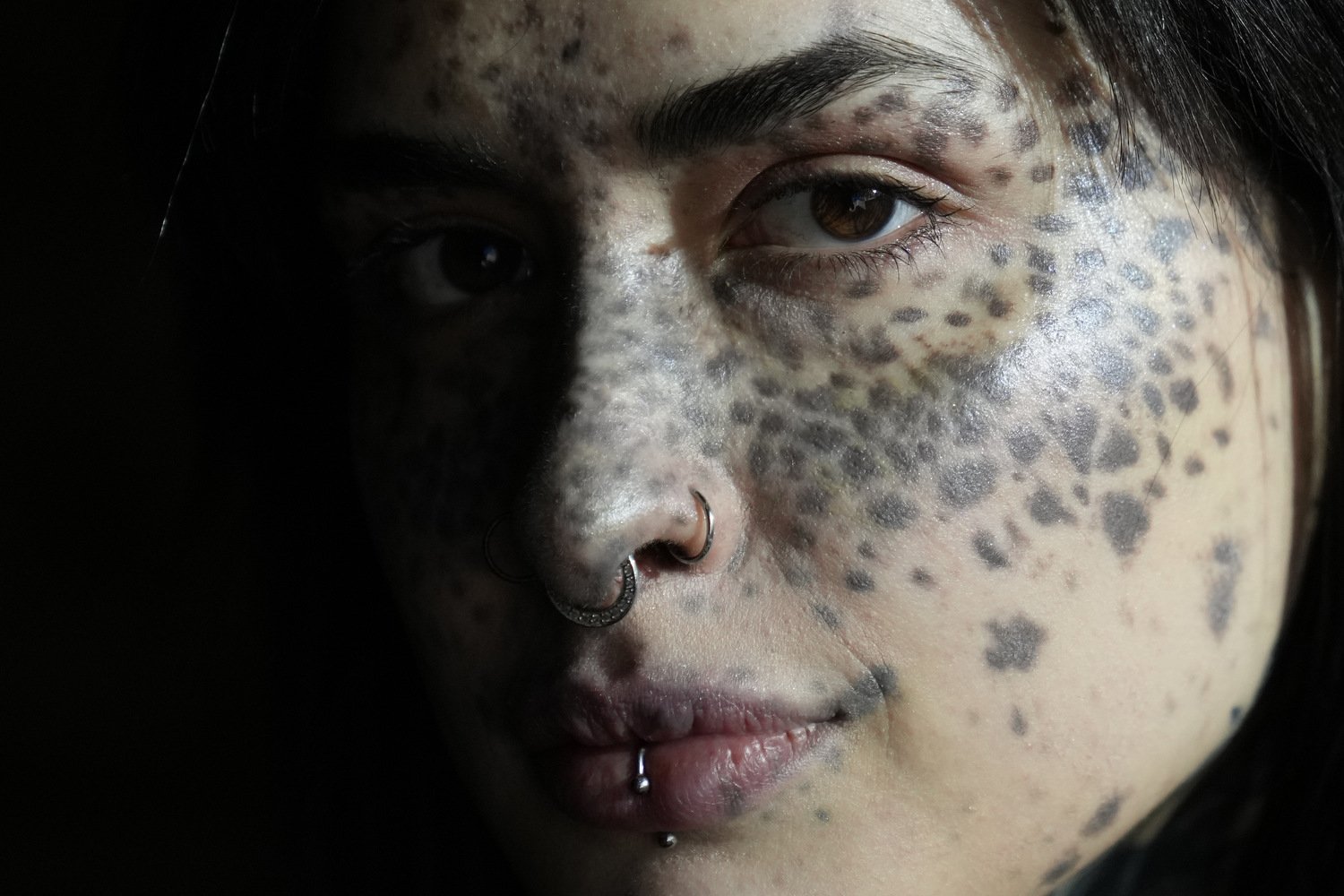  Sonia Sparta poses during a photo shoot for "L'imperfetta (The Imperfect) model agency" in Rome, Tuesday, Feb. 7, 2023. Sonia has a rare skin disorder called hyperpigmentation, which produces dark spots on her face and body. 
