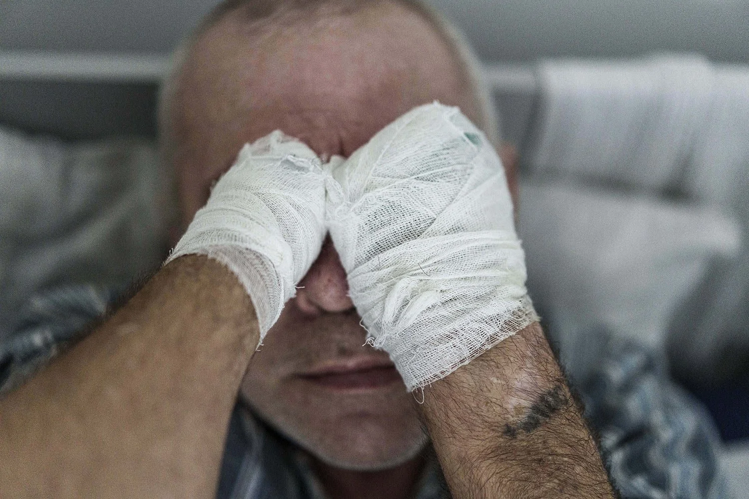  Stanislav, an injured Russian prisoner of war, lies in bed at the detention center in Ukraine's Lviv region, Thursday, April 25, 2024. (AP Photo/Evgeniy Maloletka) 