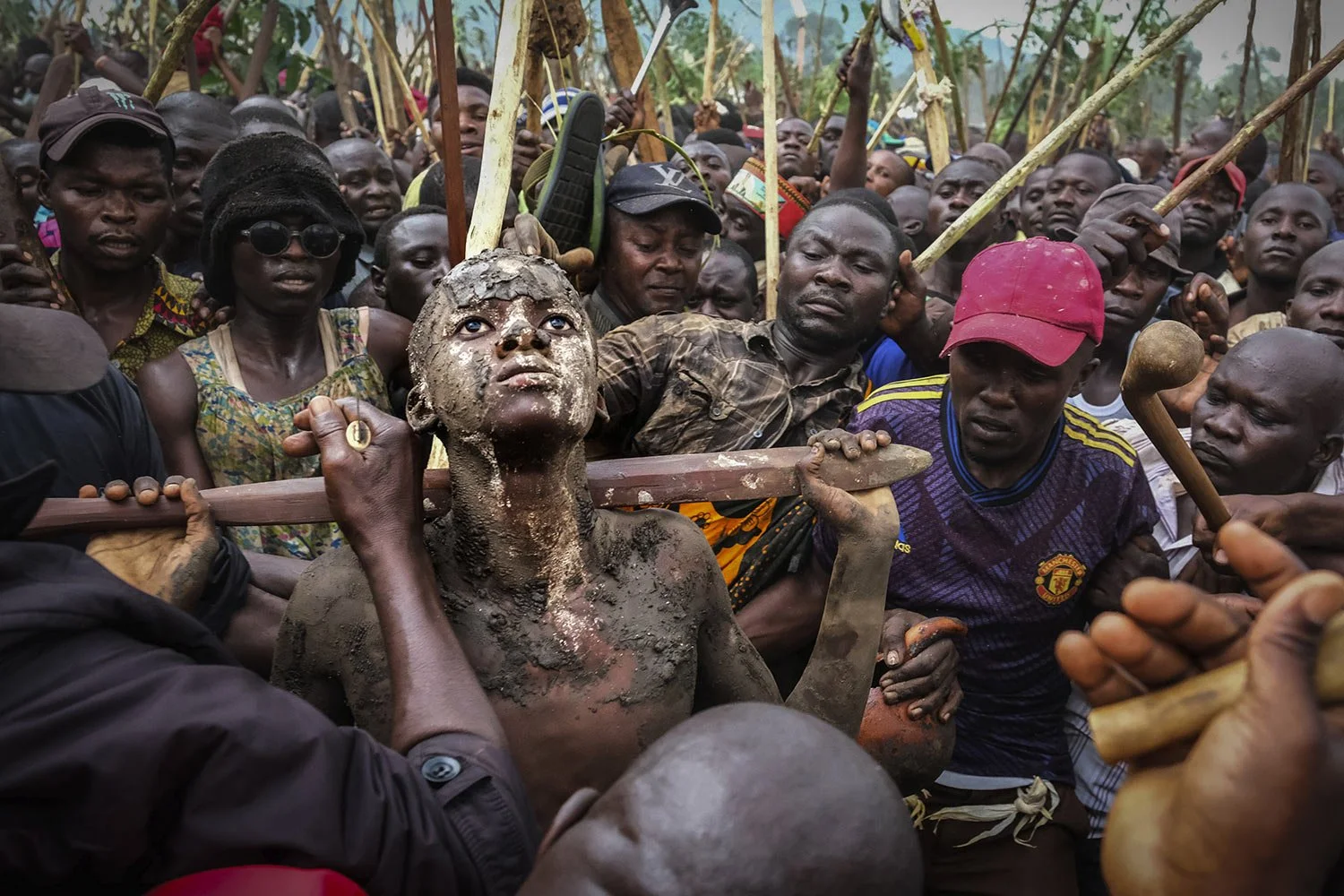  Daniel Wabuyi looks up during his traditional circumcision ritual, known as Imbalu, in Kamu village, Mbale, eastern Uganda, Saturday, Aug. 3, 2024. (AP Photo/Hajarah Nalwadda) 